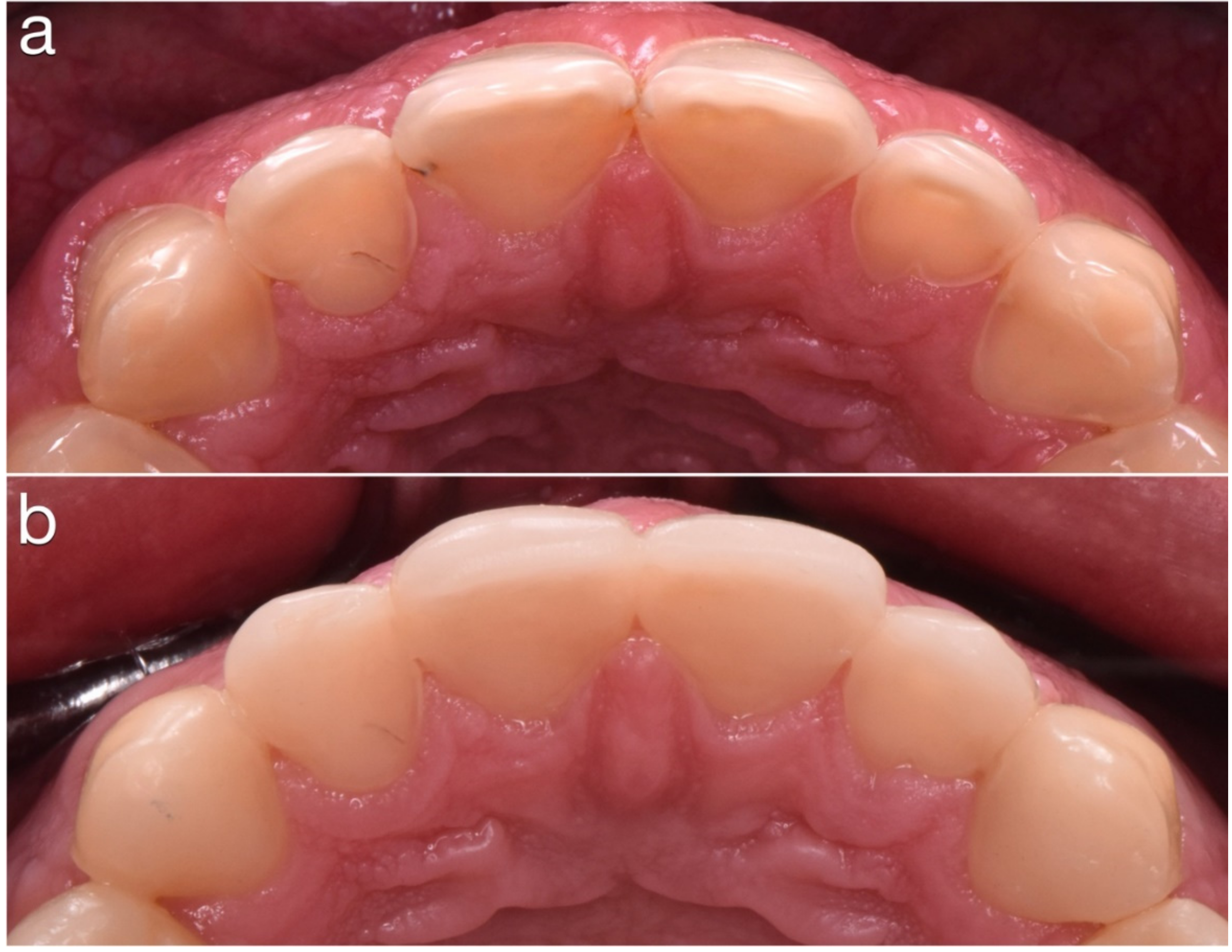 Dentistry 10 00051 g022 550