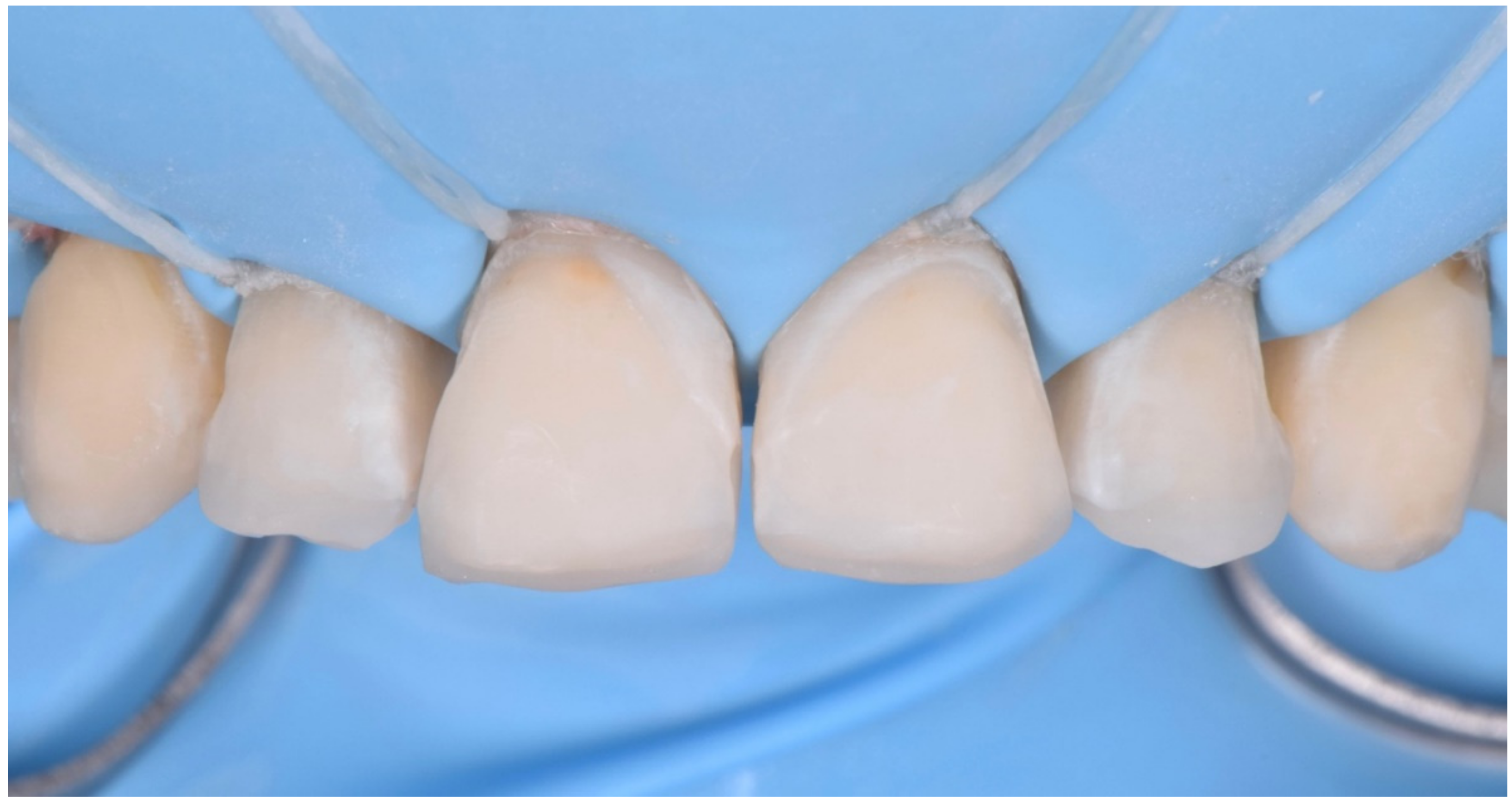 Dentistry 10 00051 g023 550