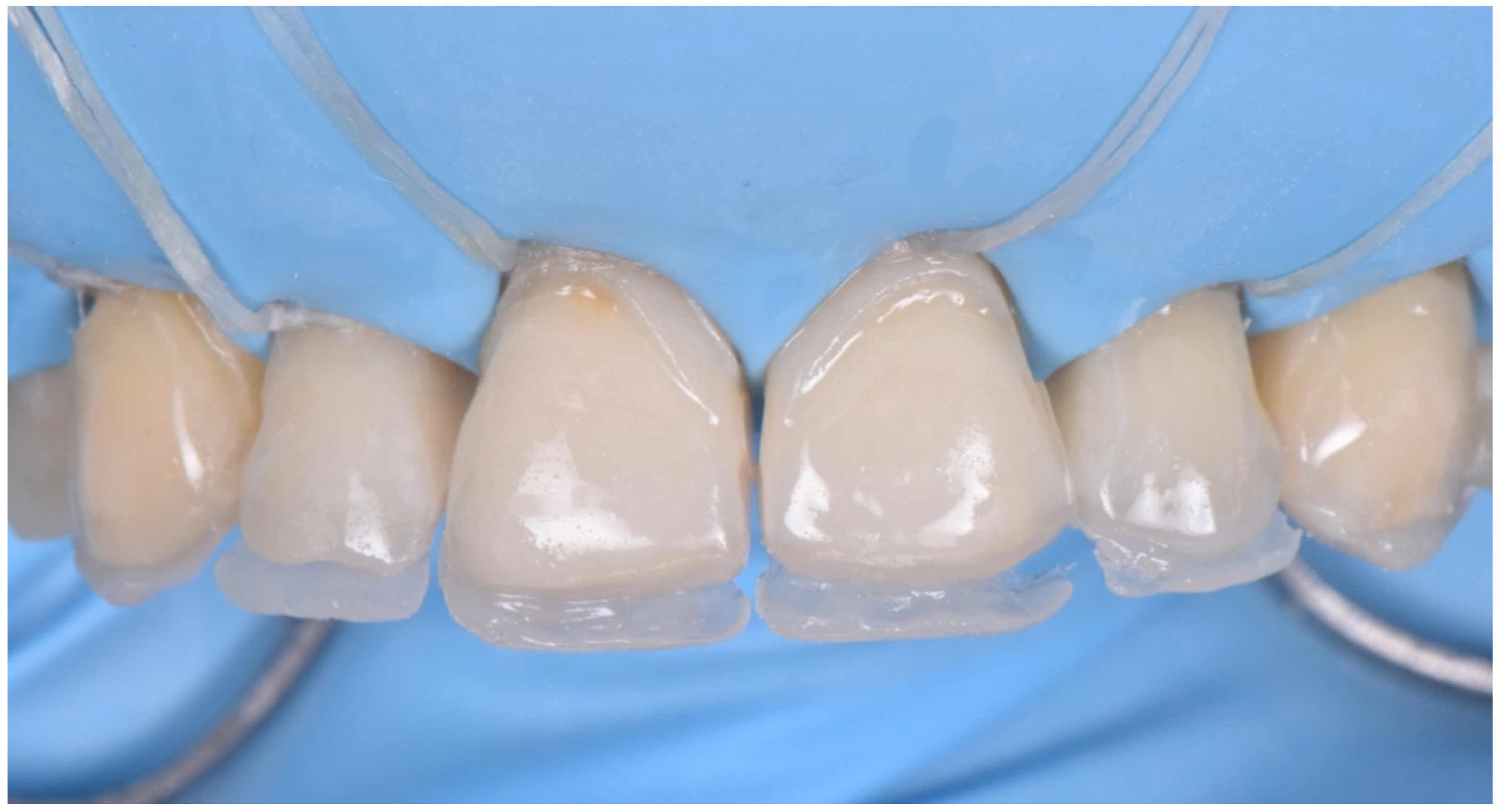 Dentistry 10 00051 g024 550