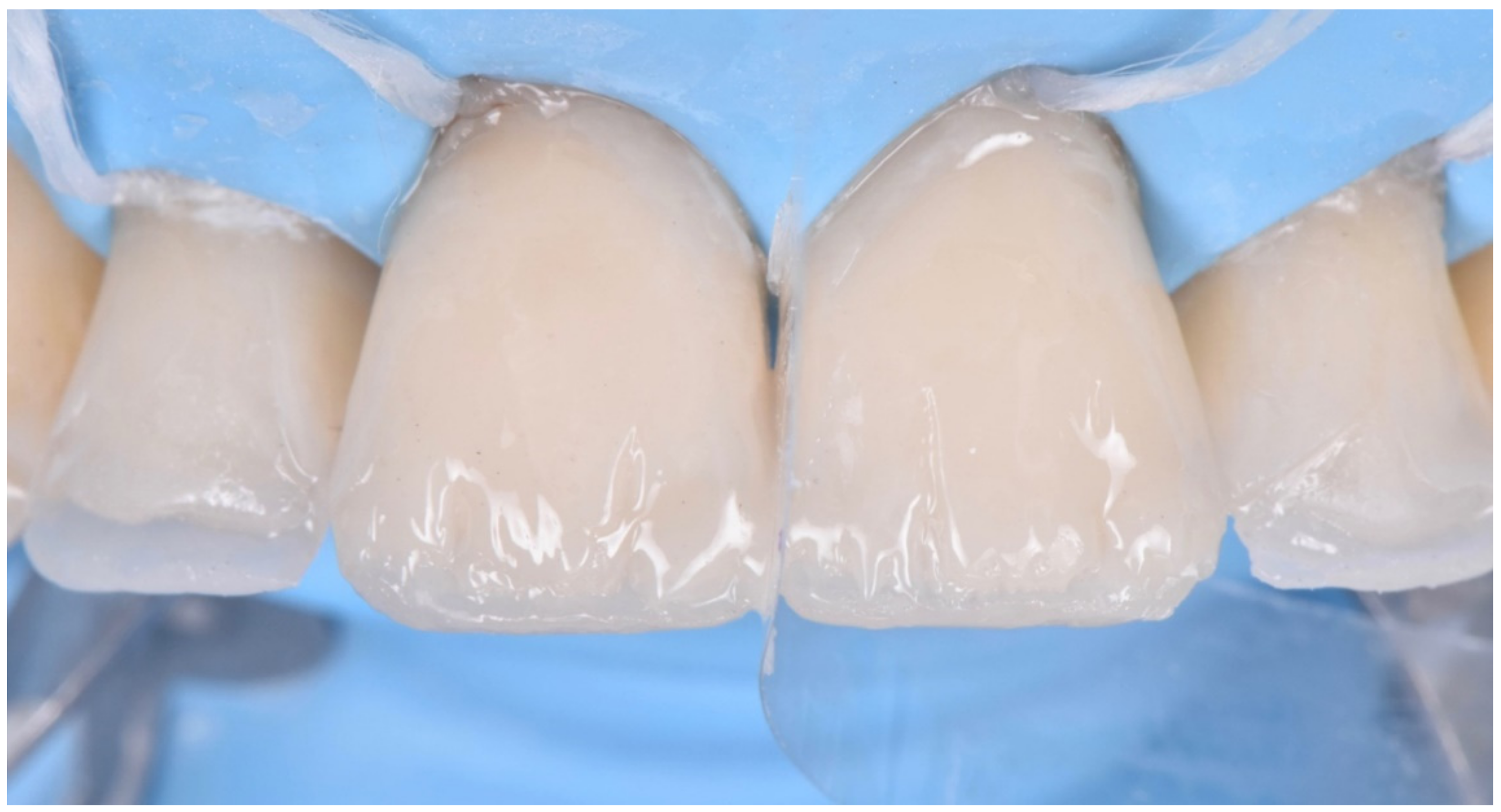 Dentistry 10 00051 g025 550