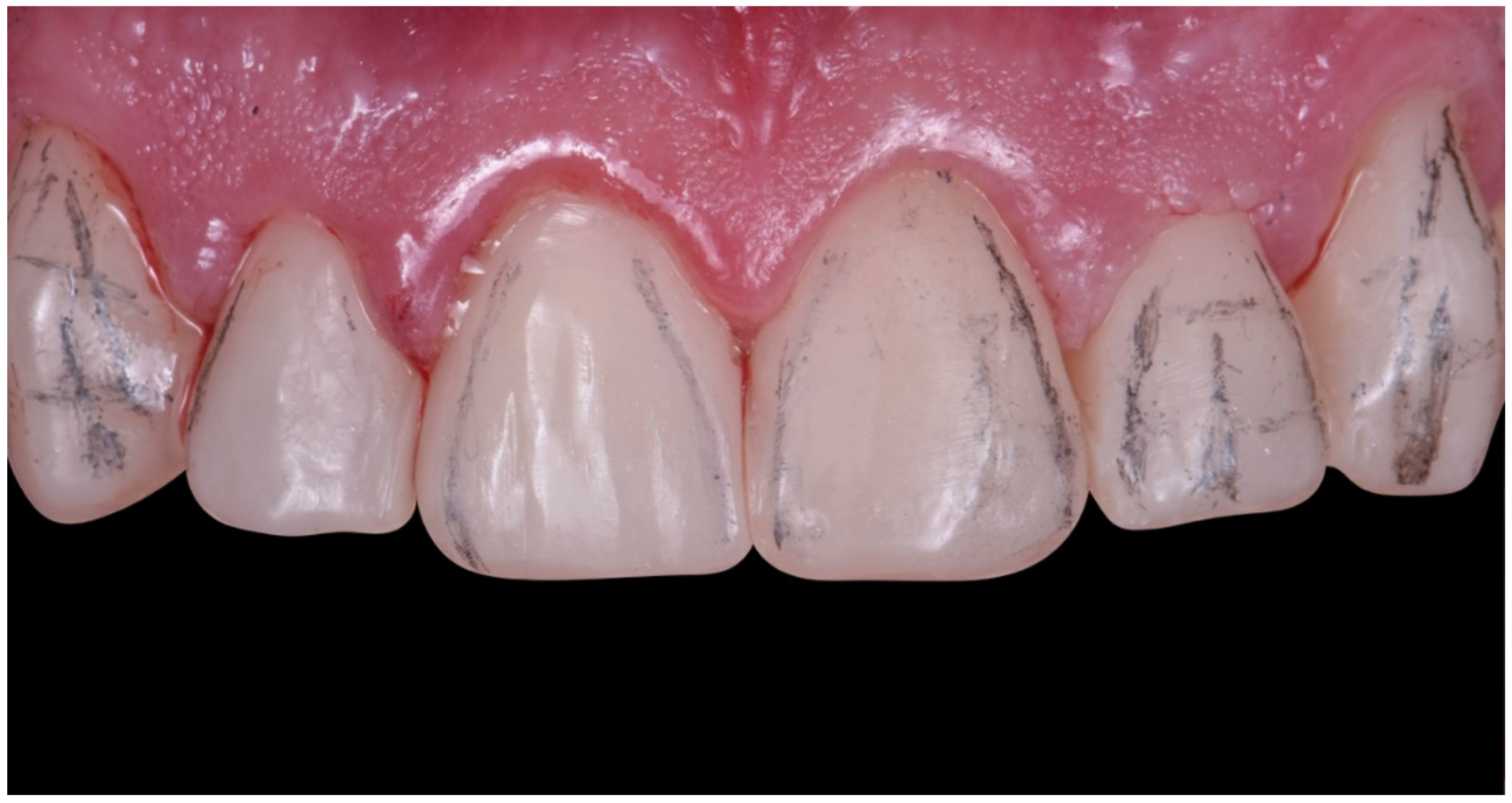 Dentistry 10 00051 g026 550