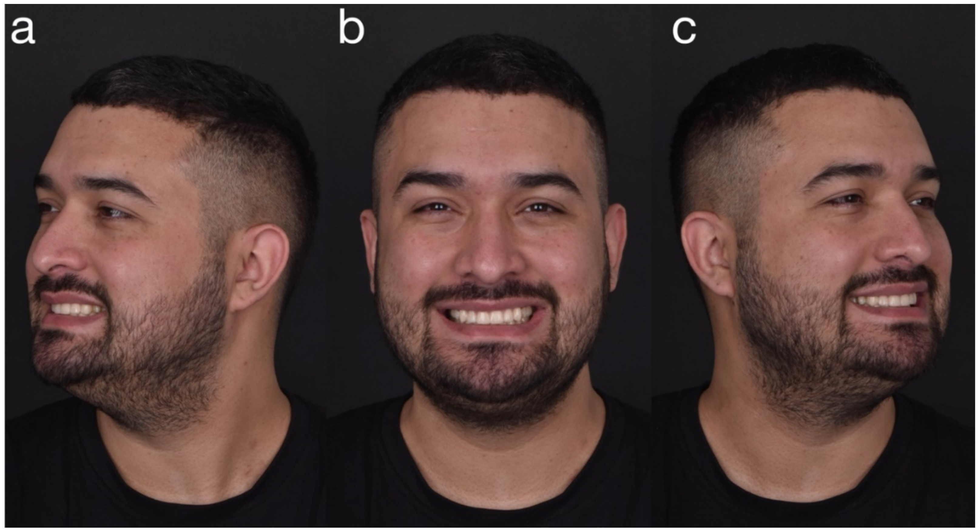 Dentistry 10 00051 g027 550