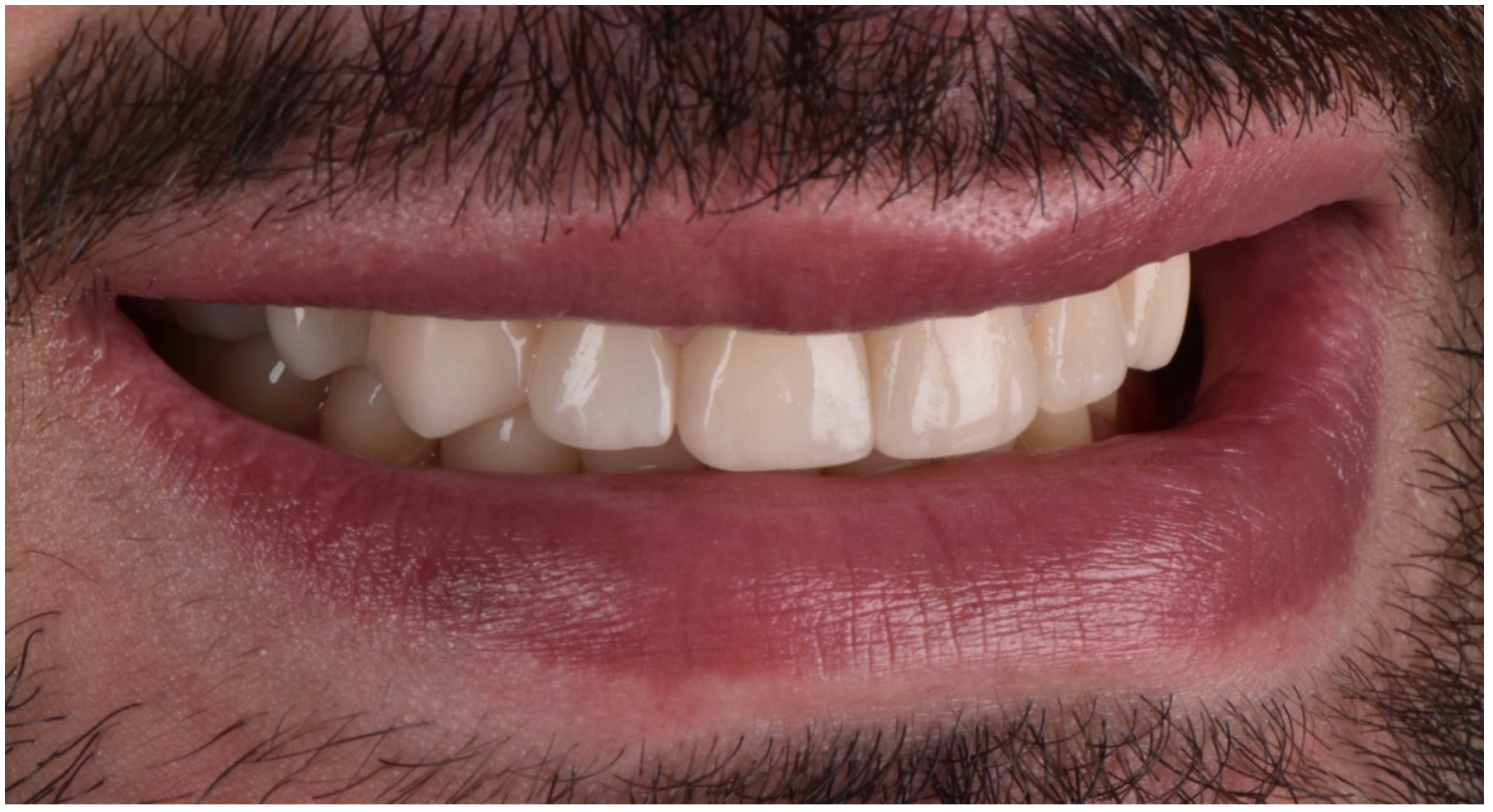 Dentistry 10 00051 g028 550