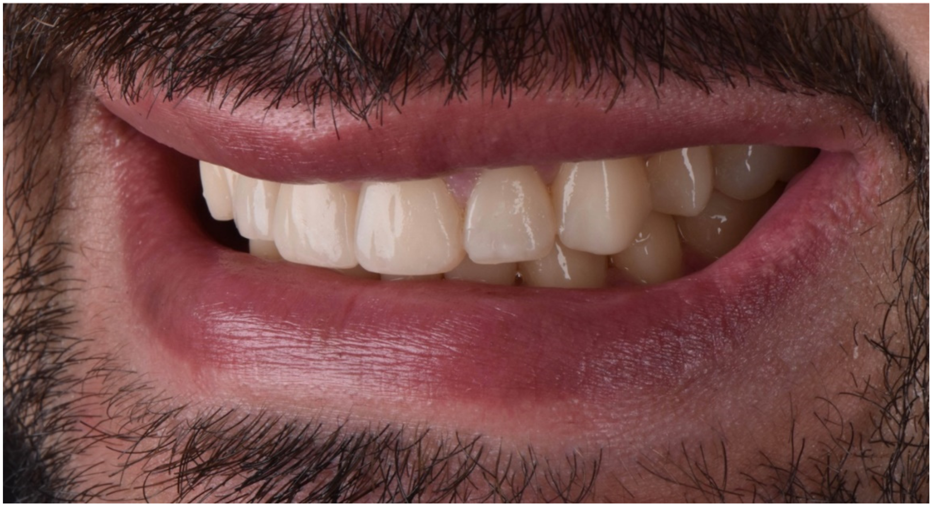 Dentistry 10 00051 g029 550