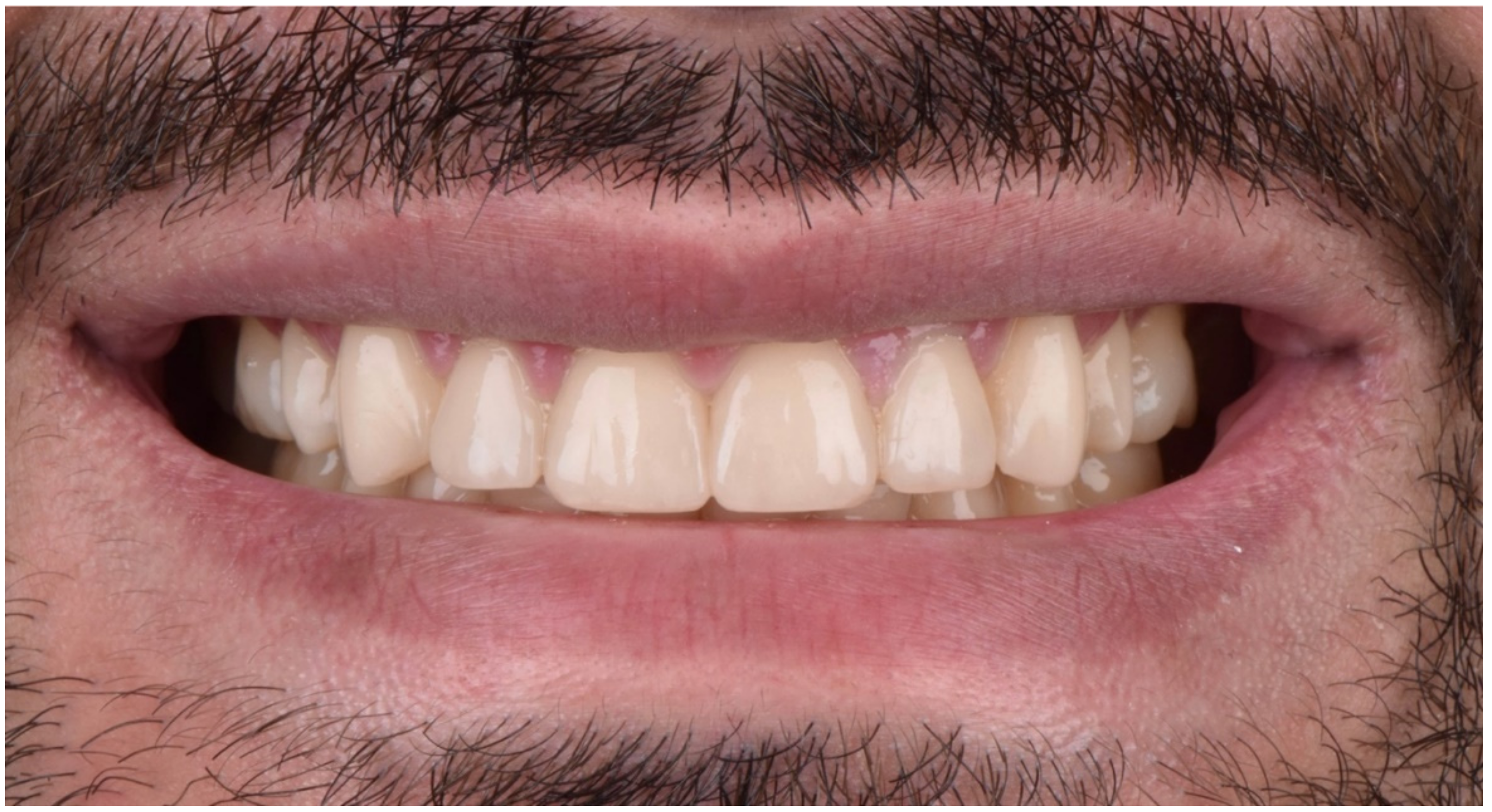 Dentistry 10 00051 g030 550