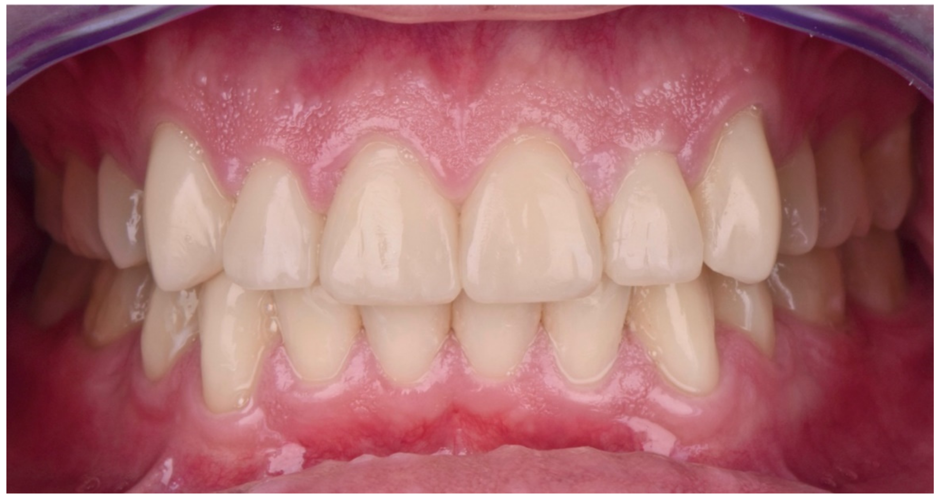 Dentistry 10 00051 g031 550