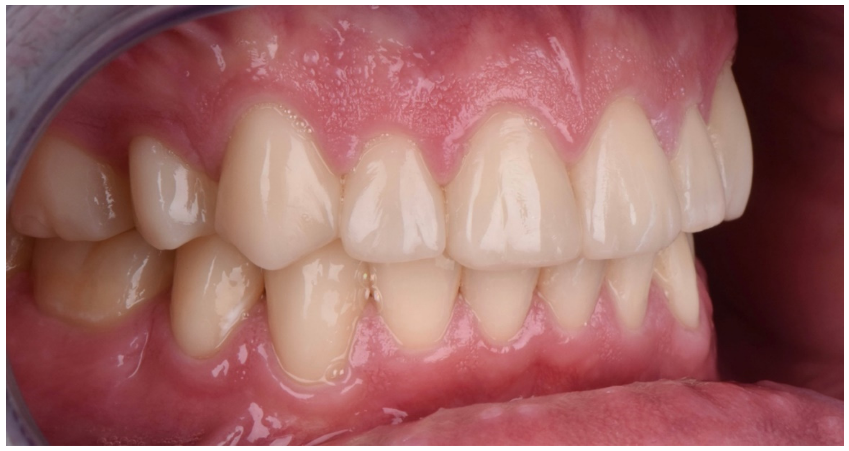 Dentistry 10 00051 g033 550