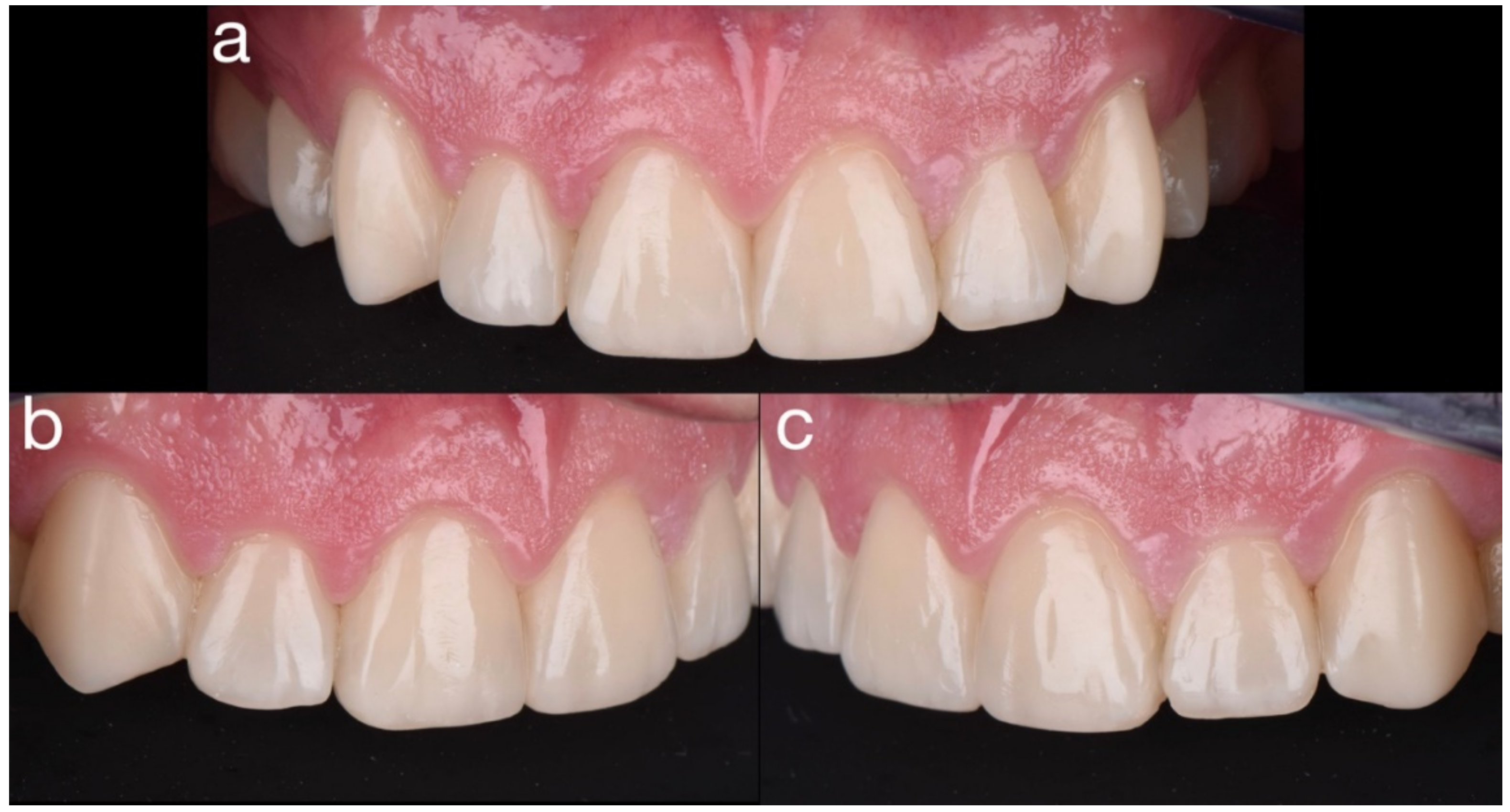 Dentistry 10 00051 g034 550