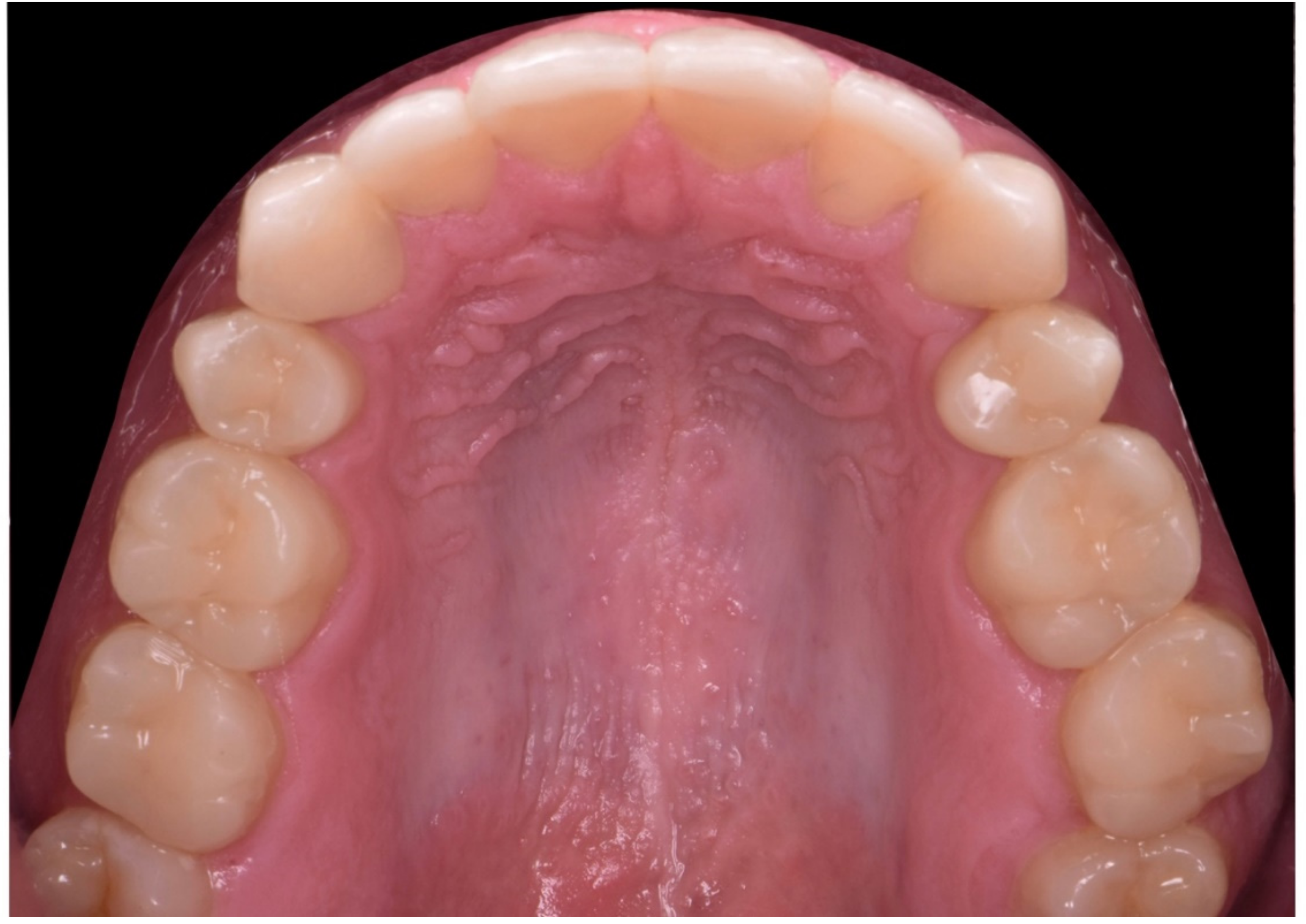 Dentistry 10 00051 g035 550