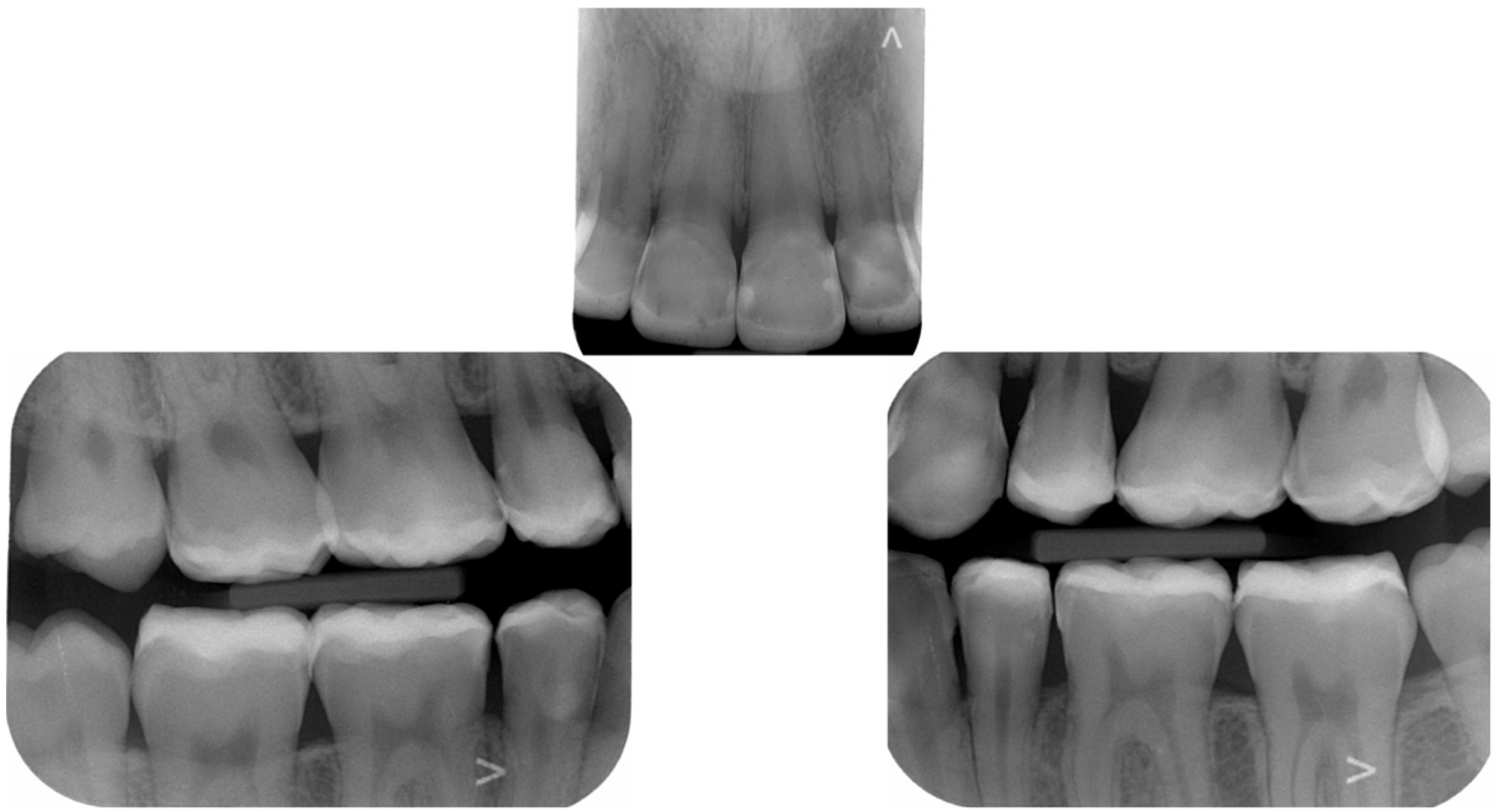 Dentistry 10 00051 g037 550