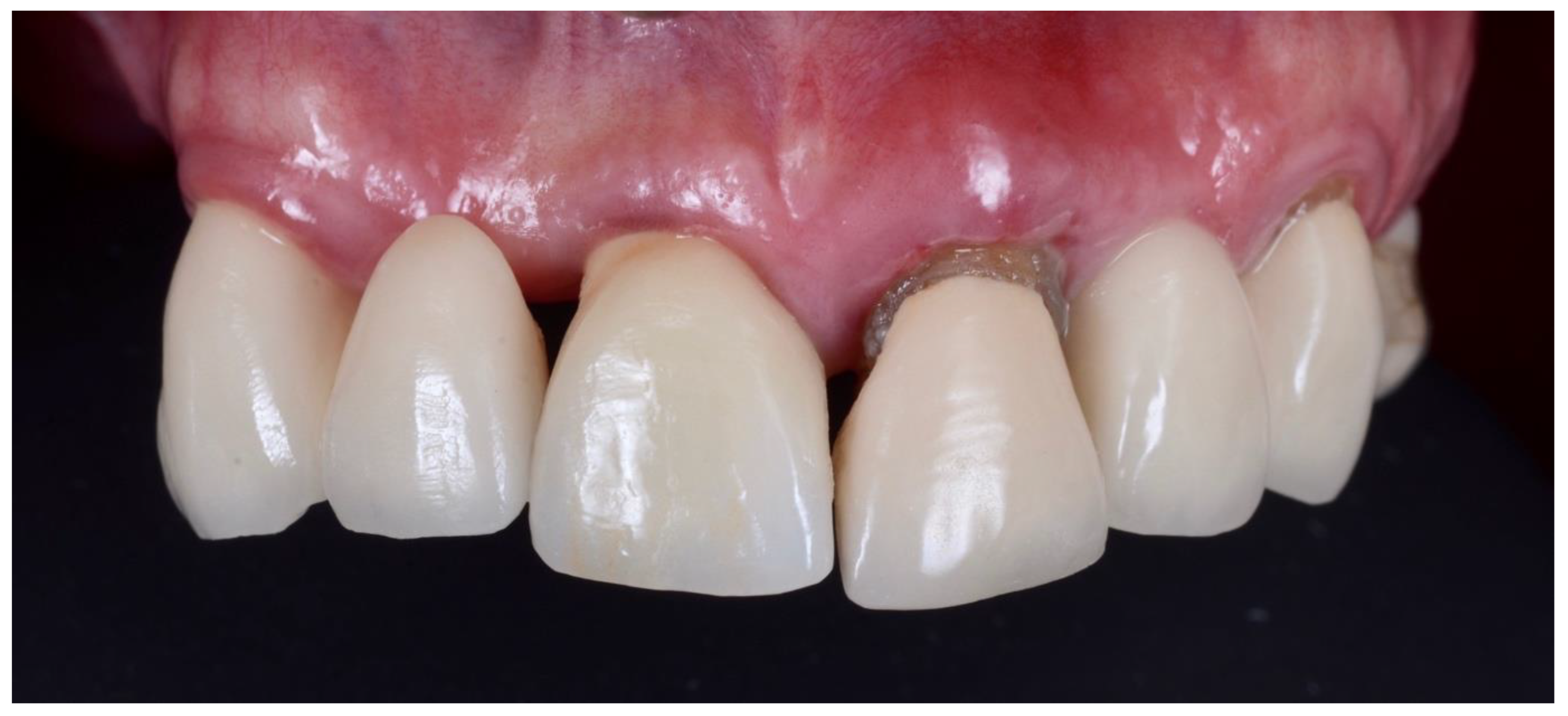 Dentistry 10 00062 g001