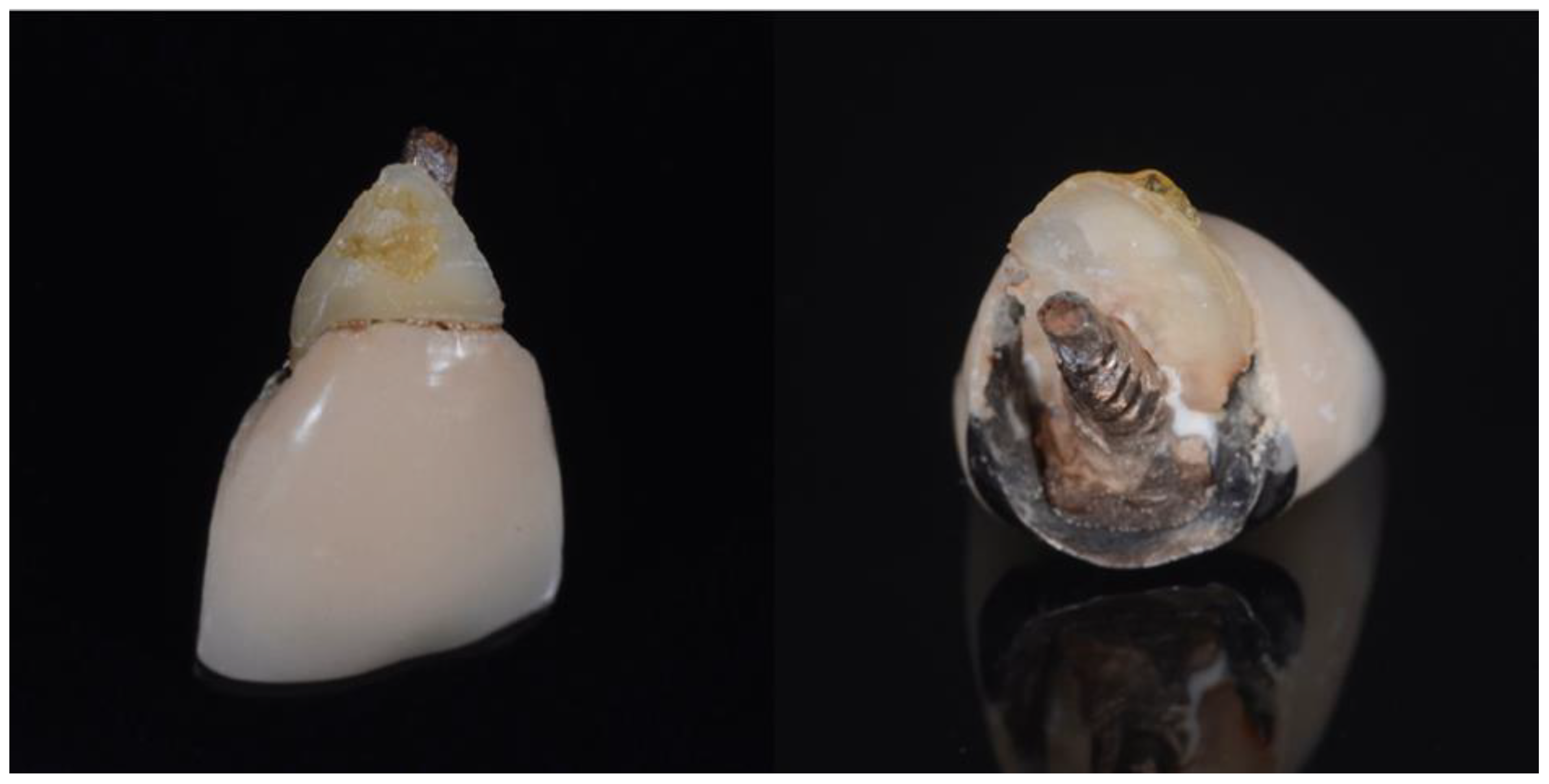 Dentistry 10 00062 g002