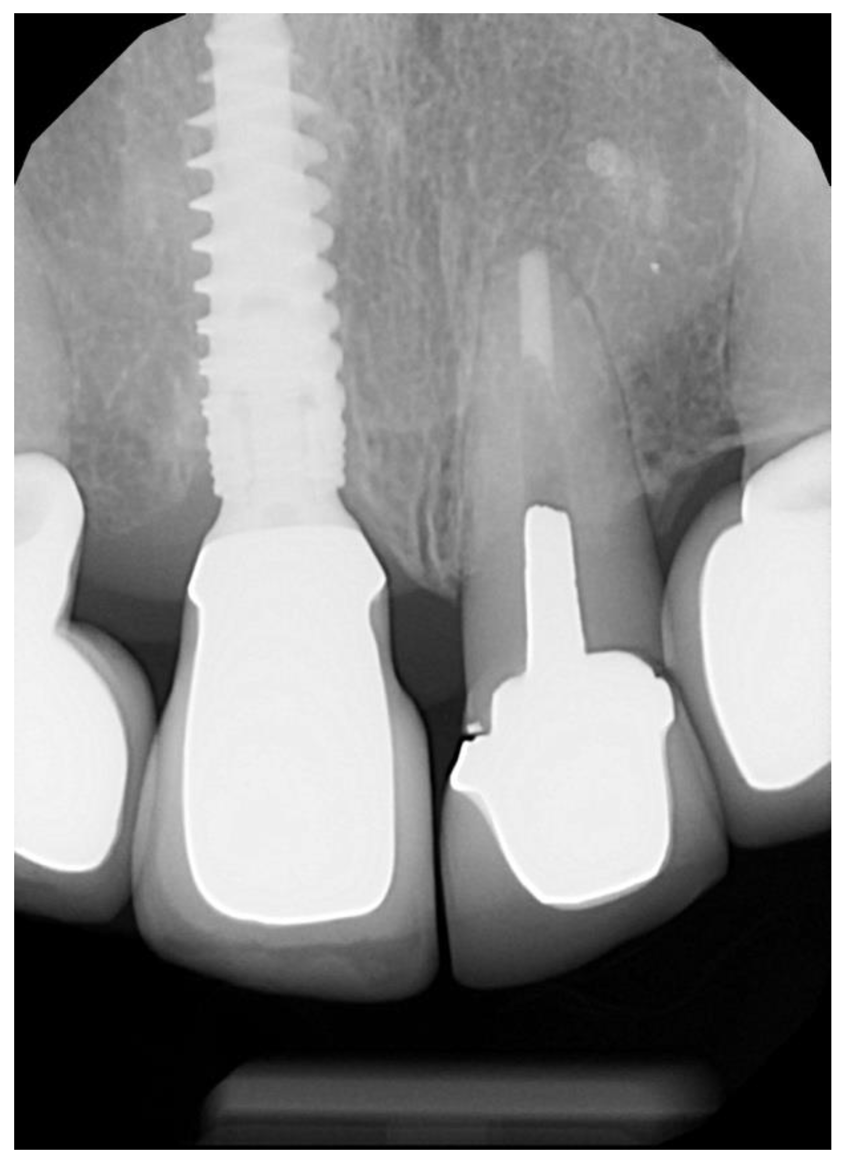 Dentistry 10 00062 g003