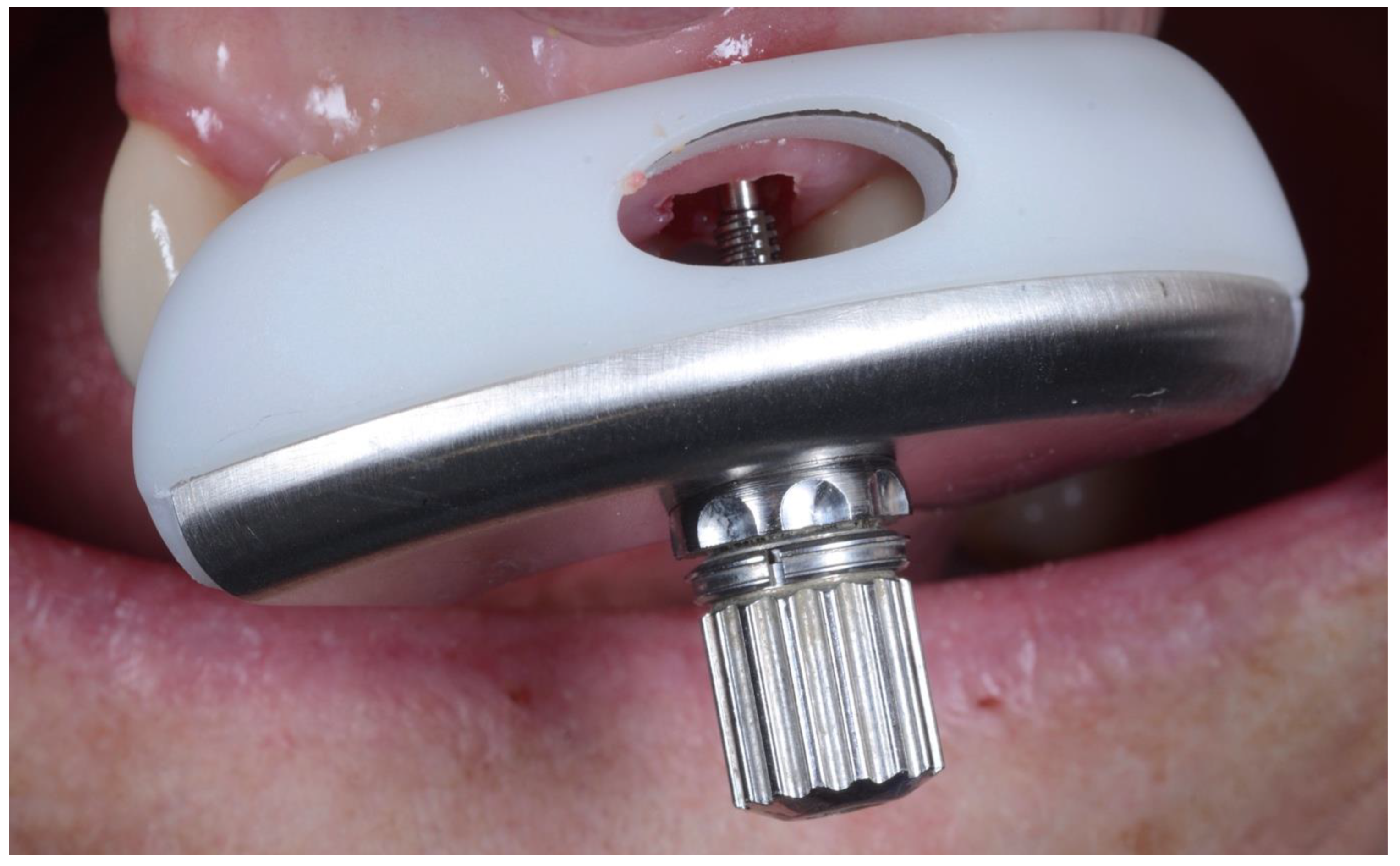 Dentistry 10 00062 g006