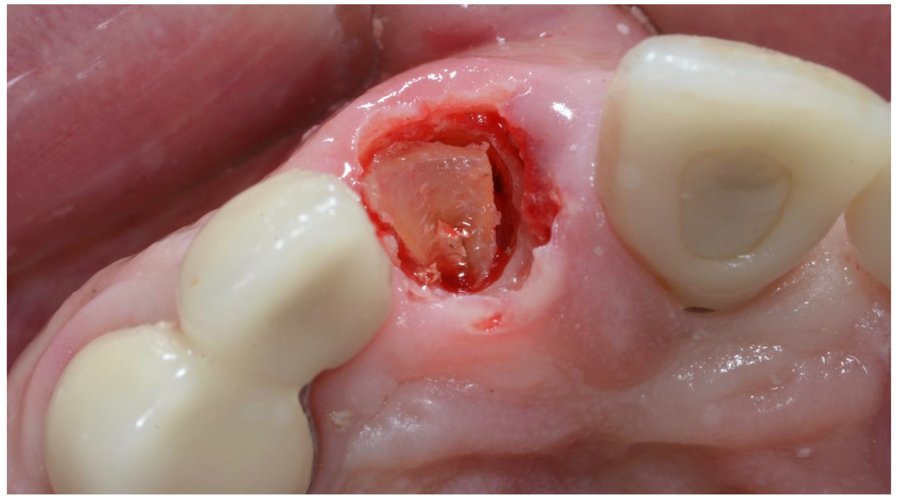 Dentistry 10 00062 g007
