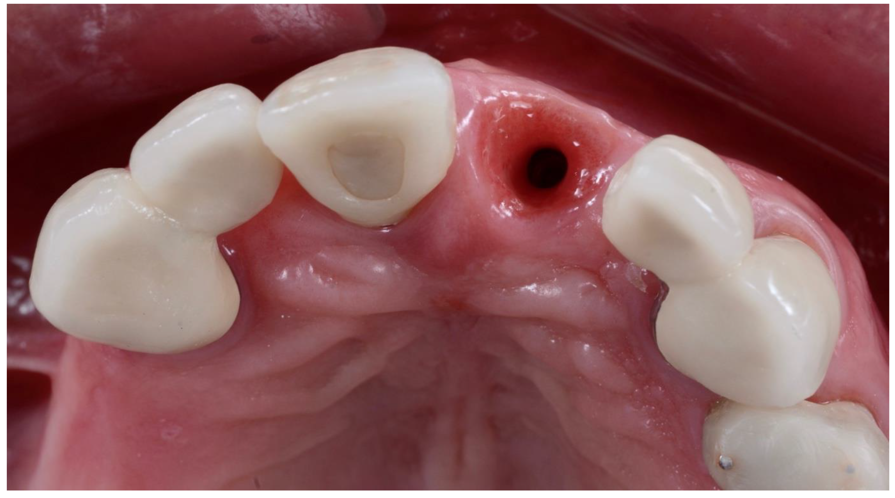 Dentistry 10 00062 g011