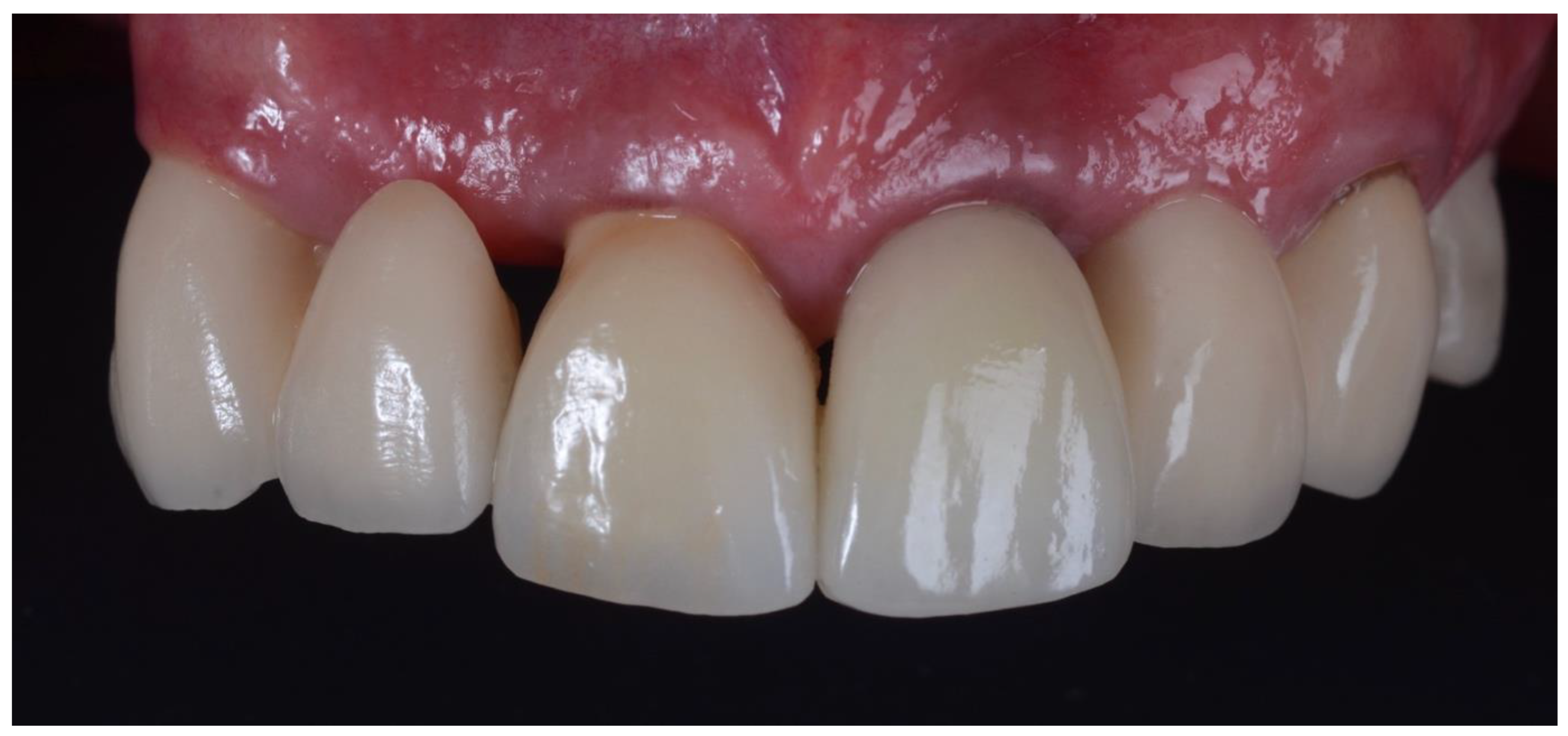 Dentistry 10 00062 g012