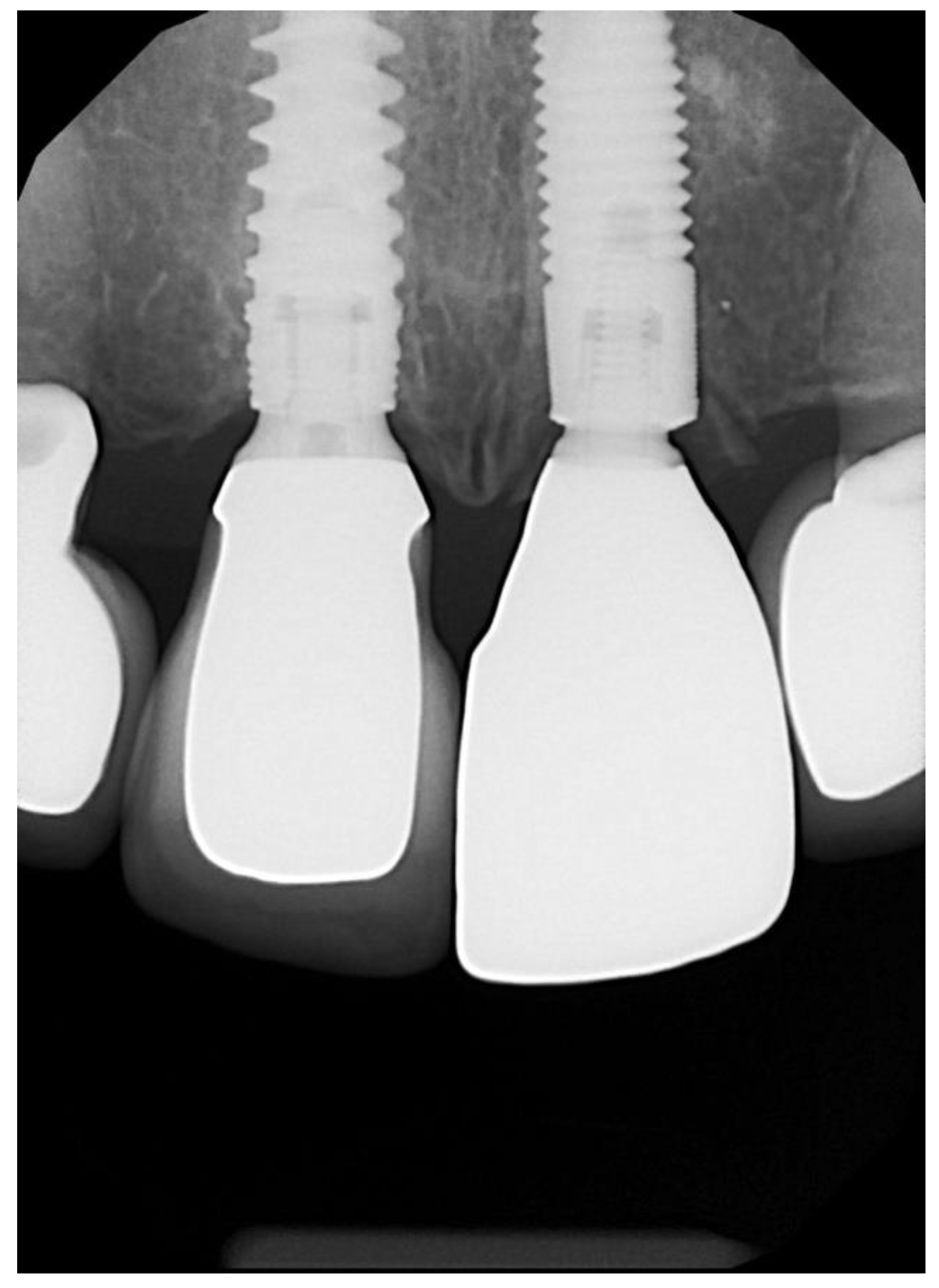 Dentistry 10 00062 g013