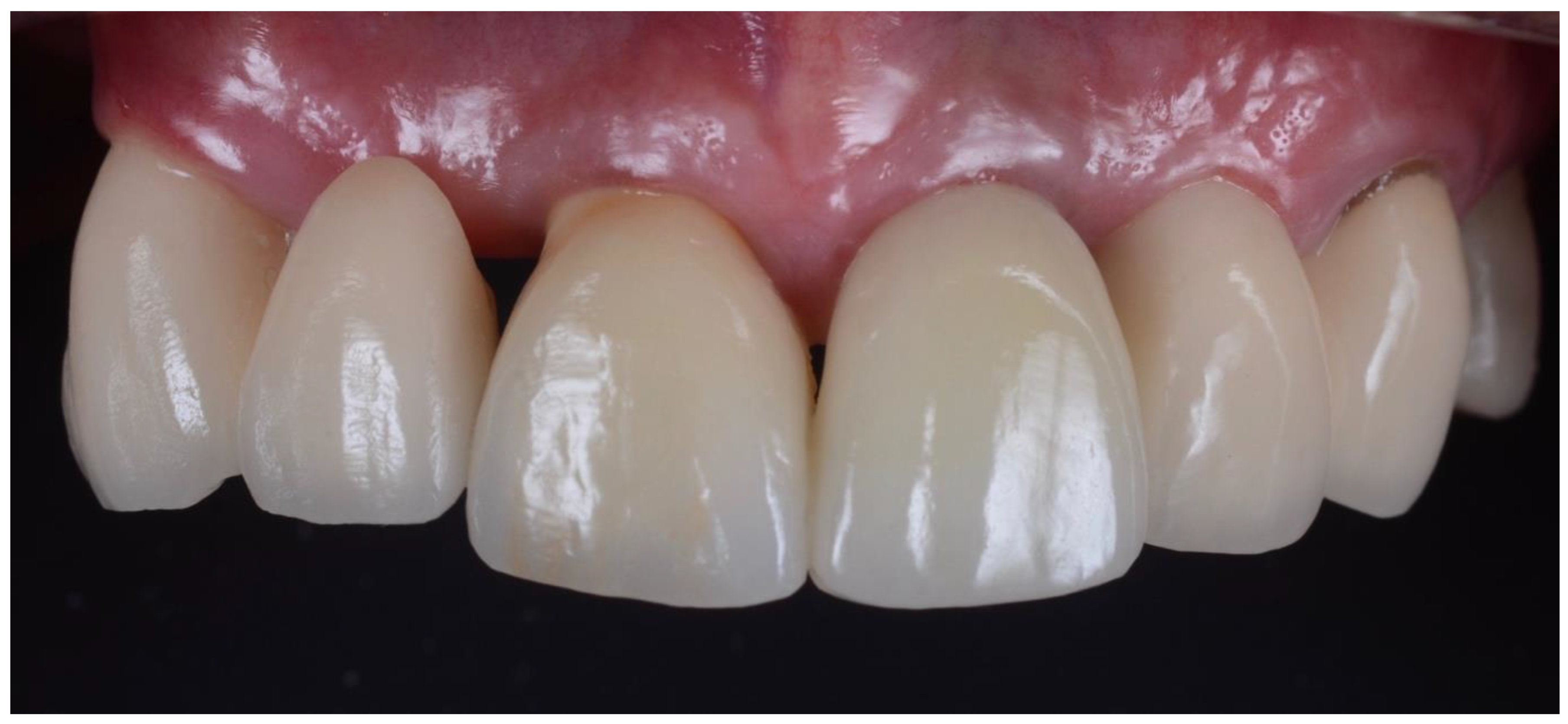 Dentistry 10 00062 g014