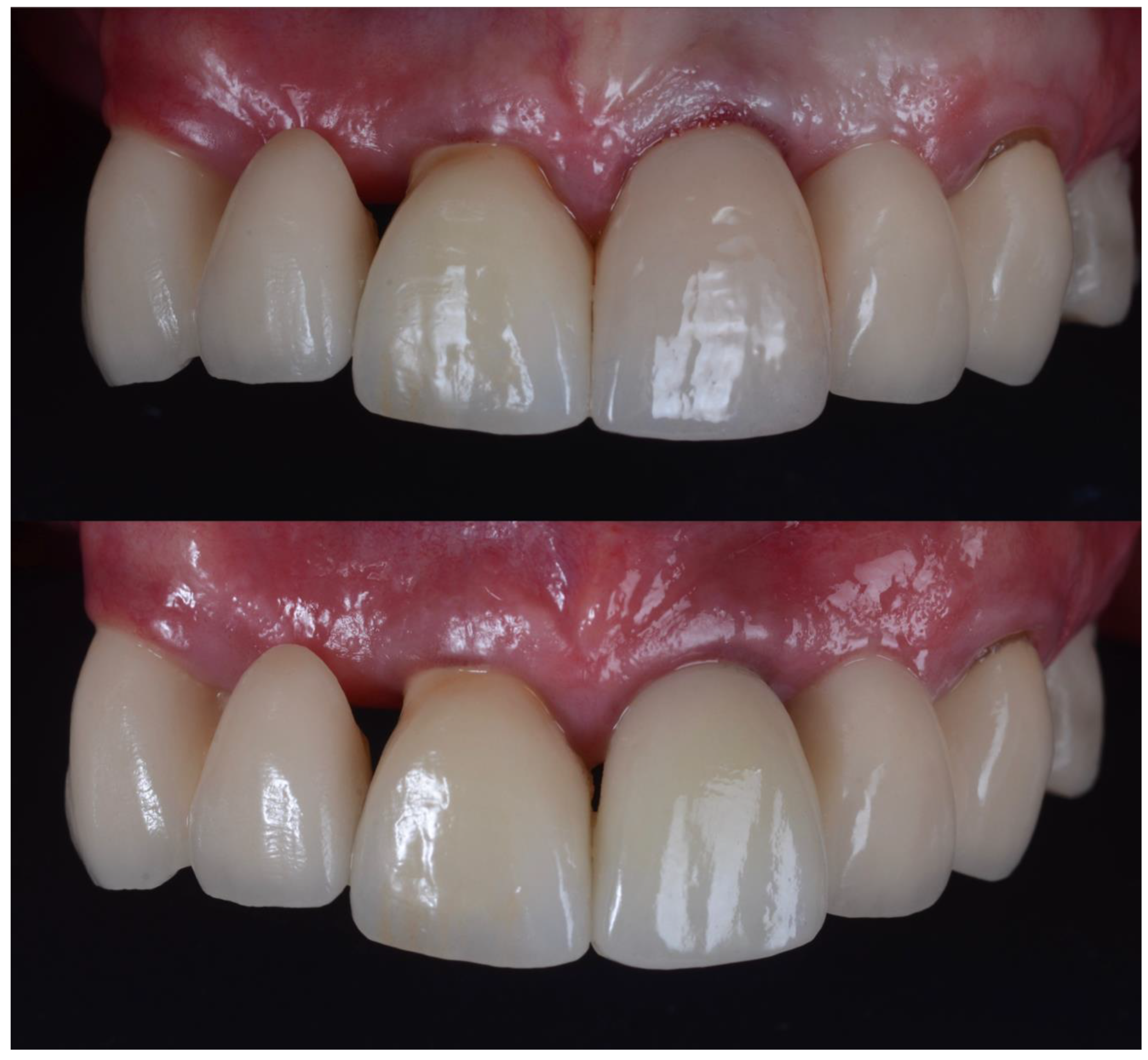 Dentistry 10 00062 g017