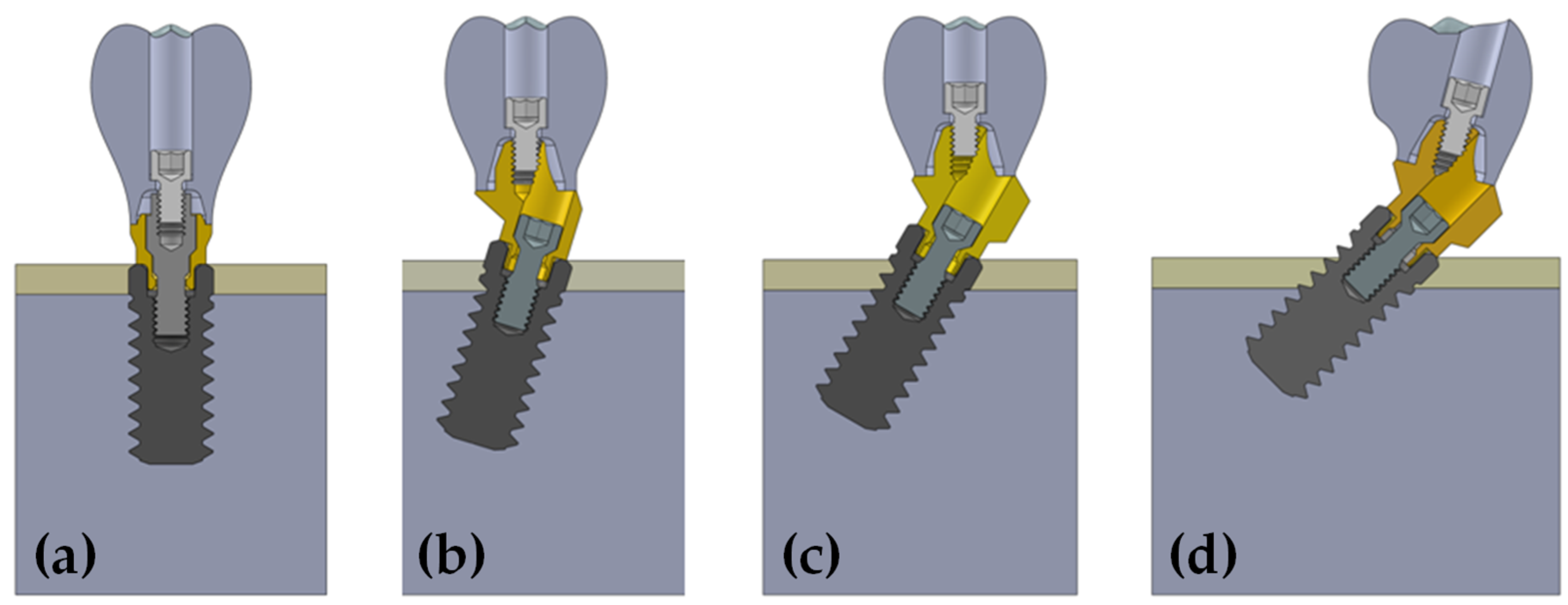 Dentistry 10 00077 g001 550