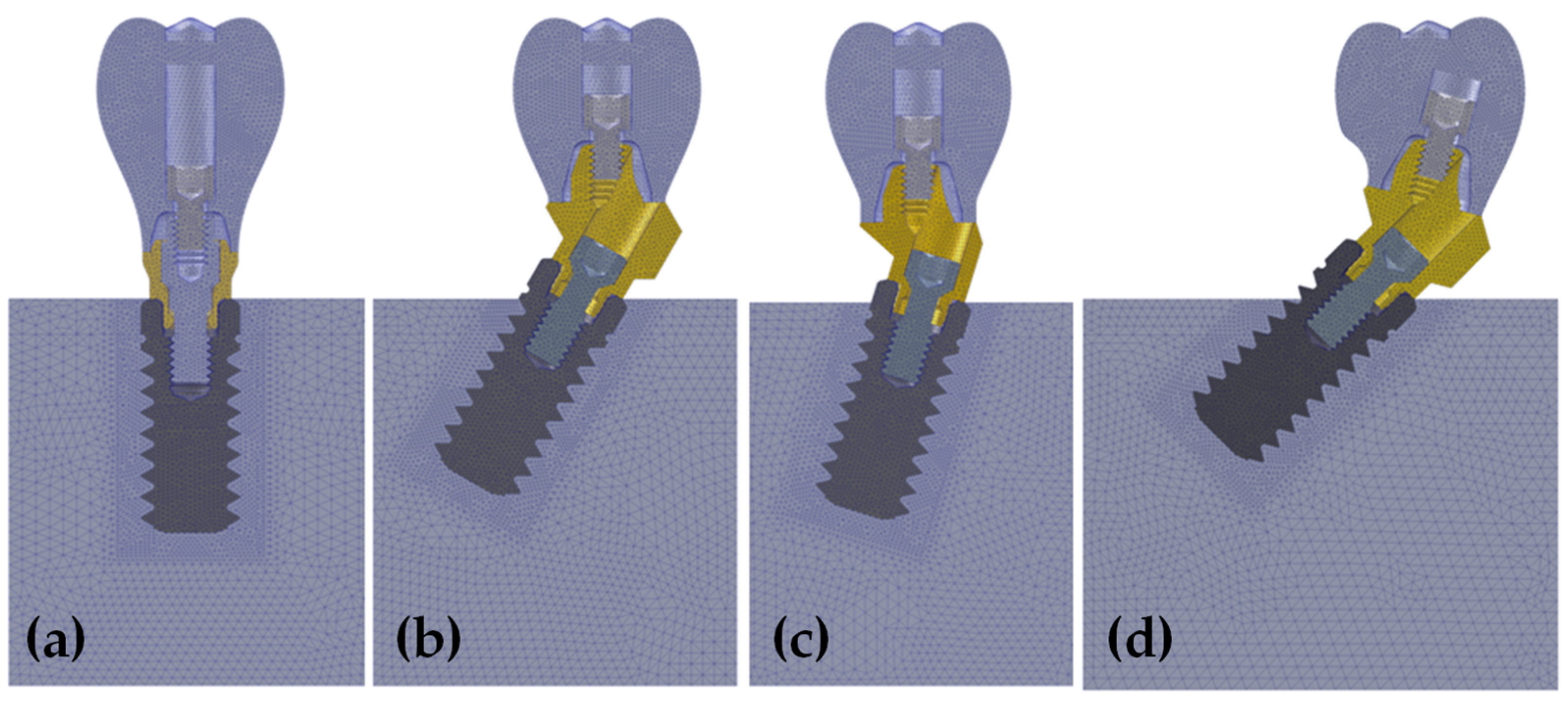 Dentistry 10 00077 g002 550