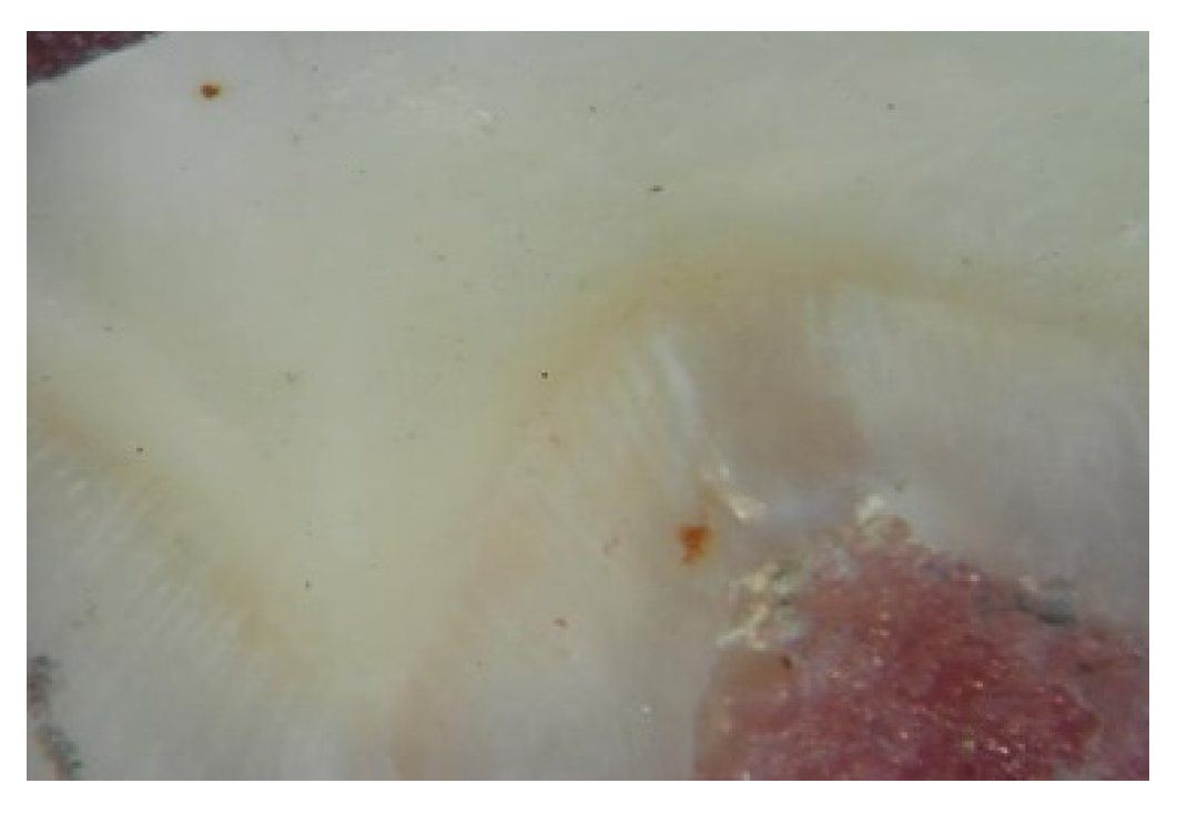 Dentistry 10 00100 g003