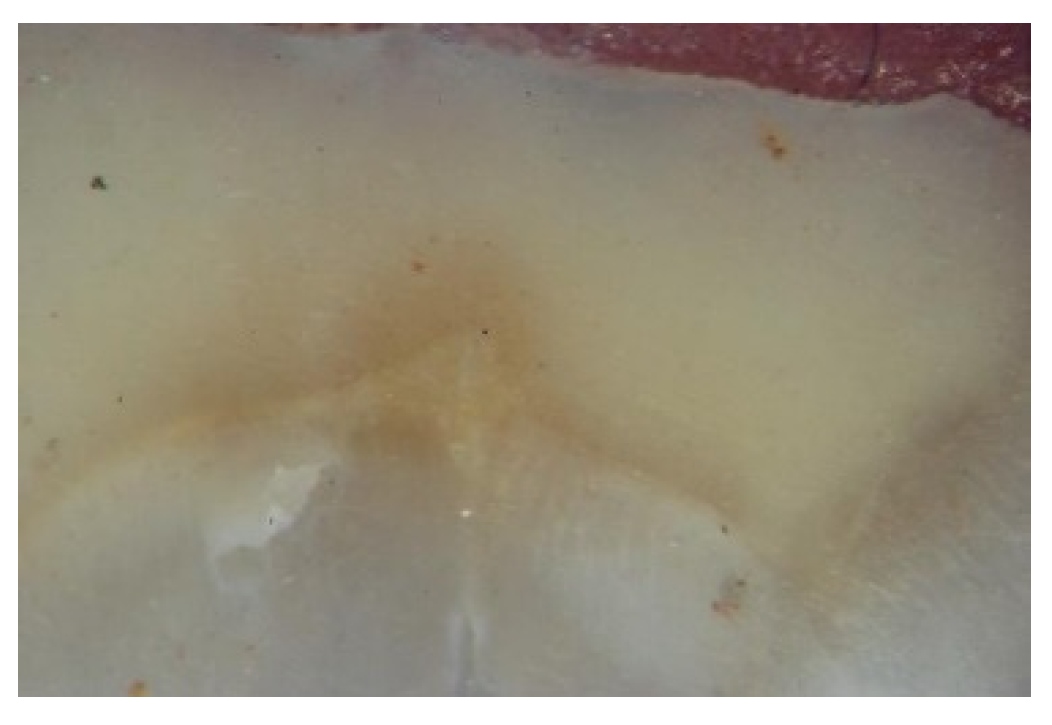 Dentistry 10 00100 g004