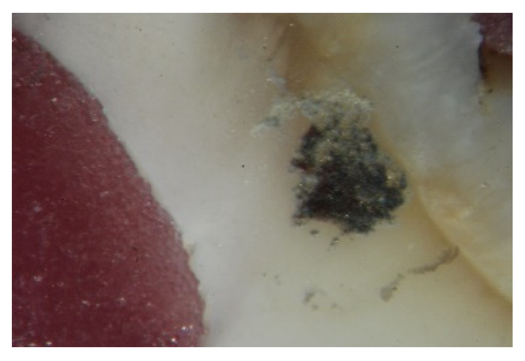 Dentistry 10 00100 g005