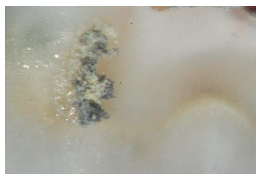 Dentistry 10 00100 g006