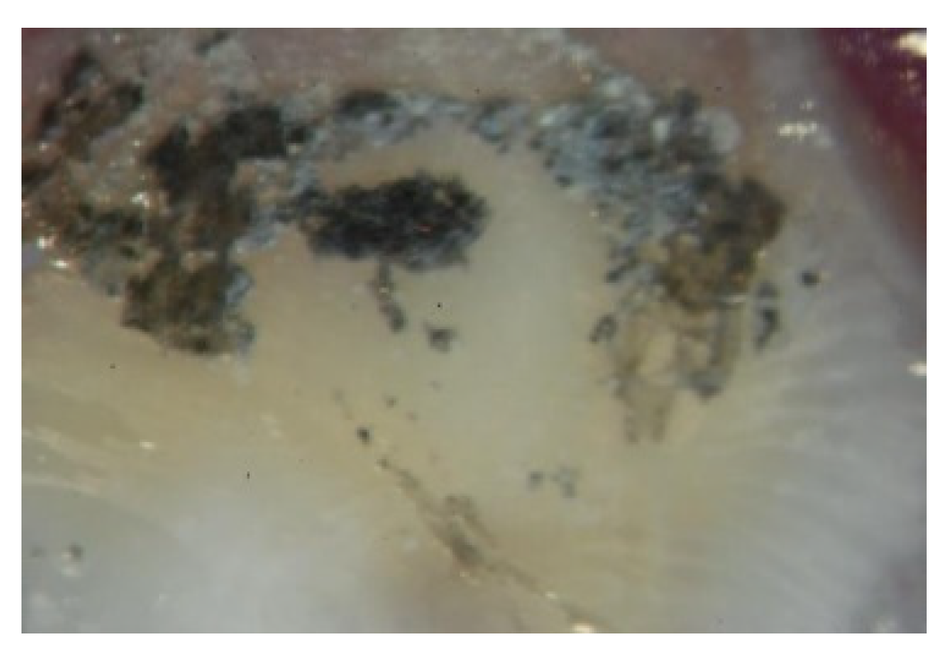 Dentistry 10 00100 g007