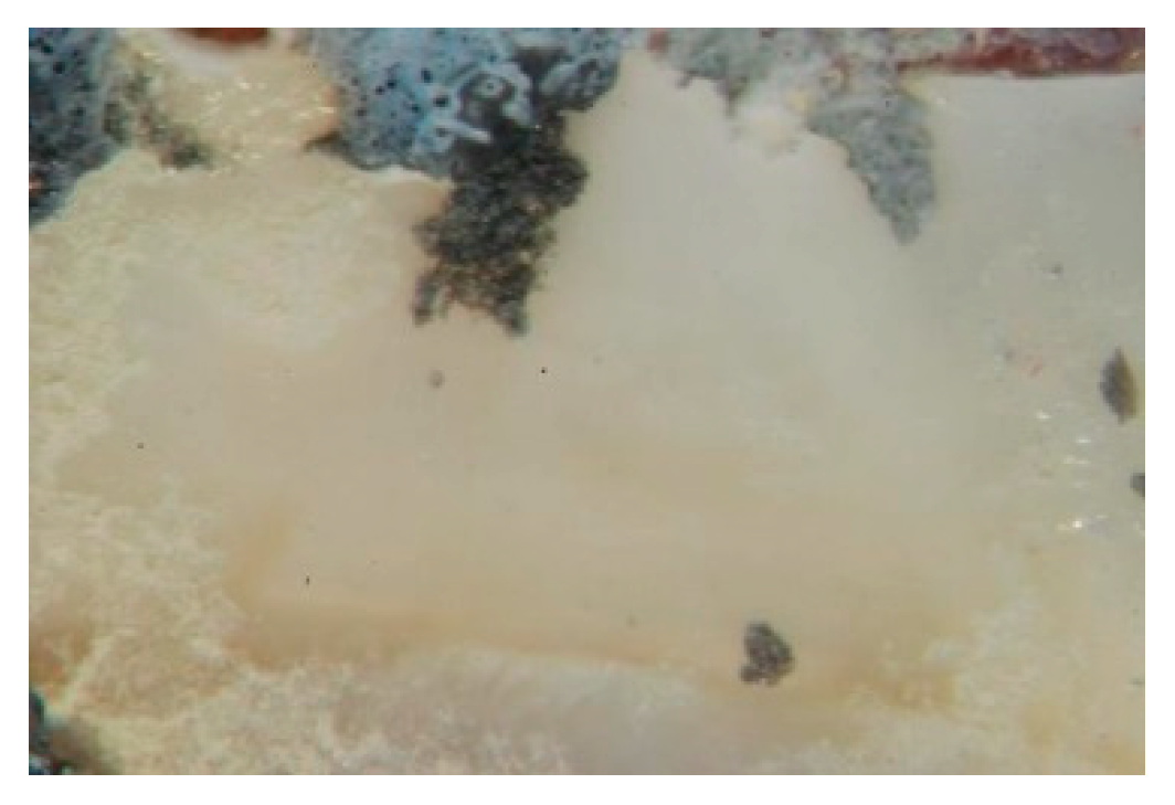 Dentistry 10 00100 g008