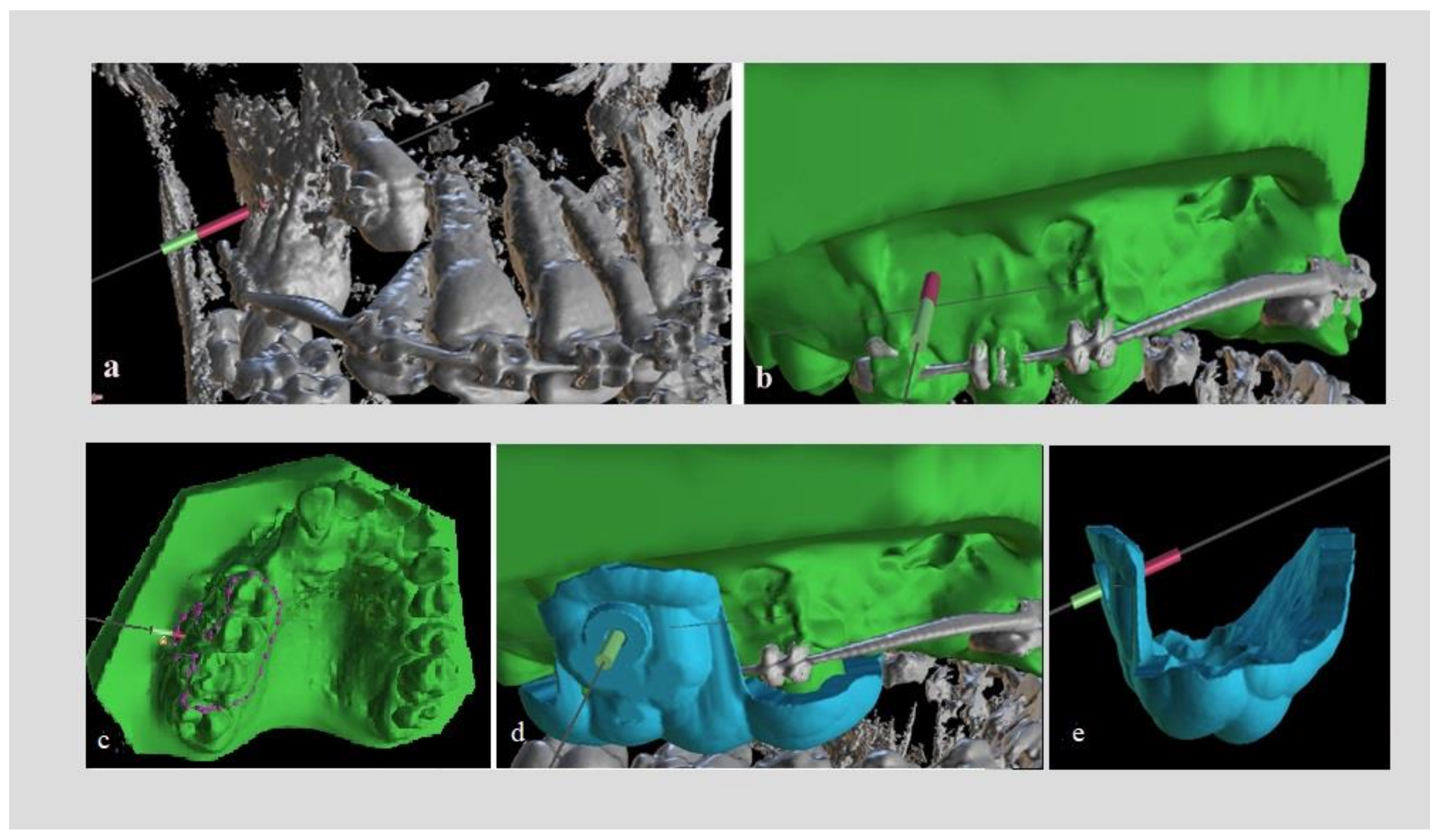 Dentistry 10 00104 g001