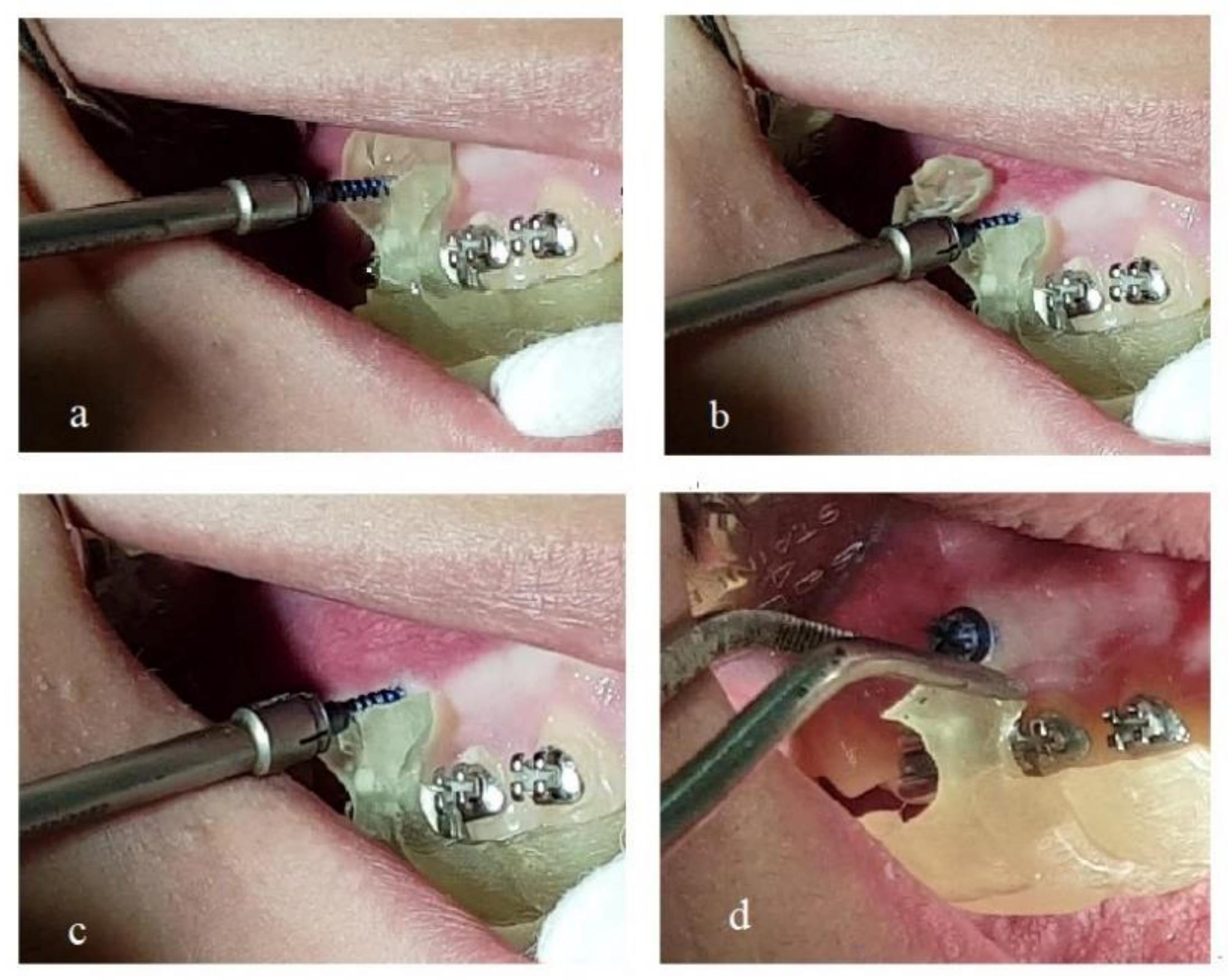 Dentistry 10 00104 g003