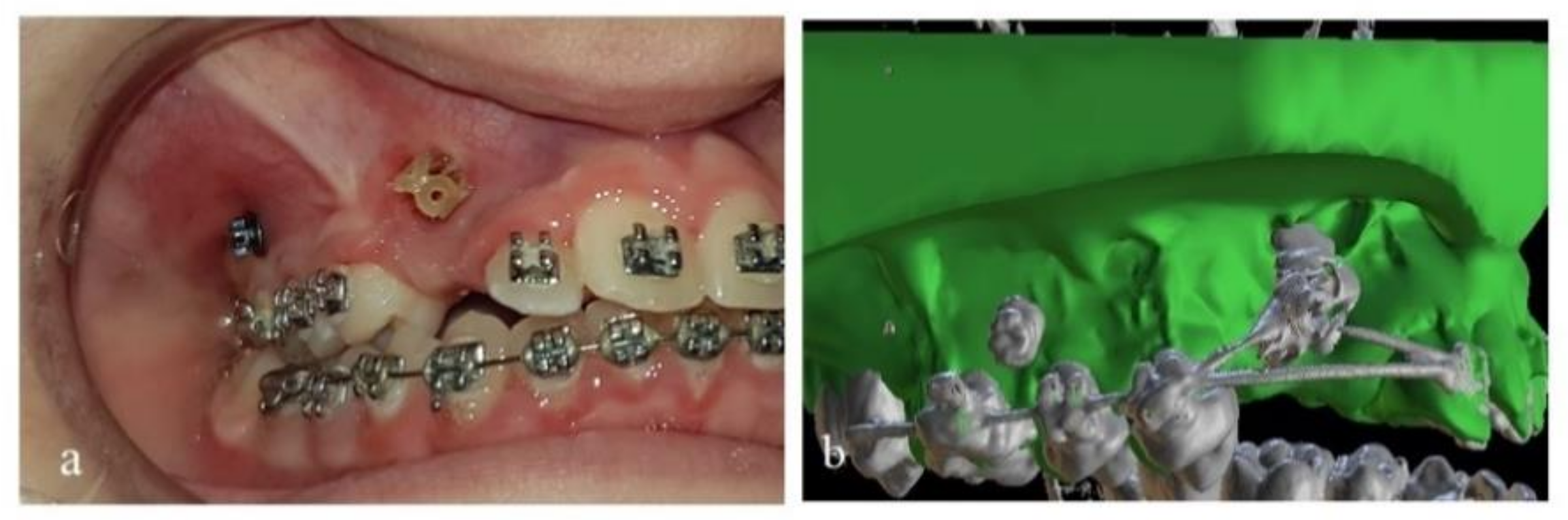 Dentistry 10 00104 g004