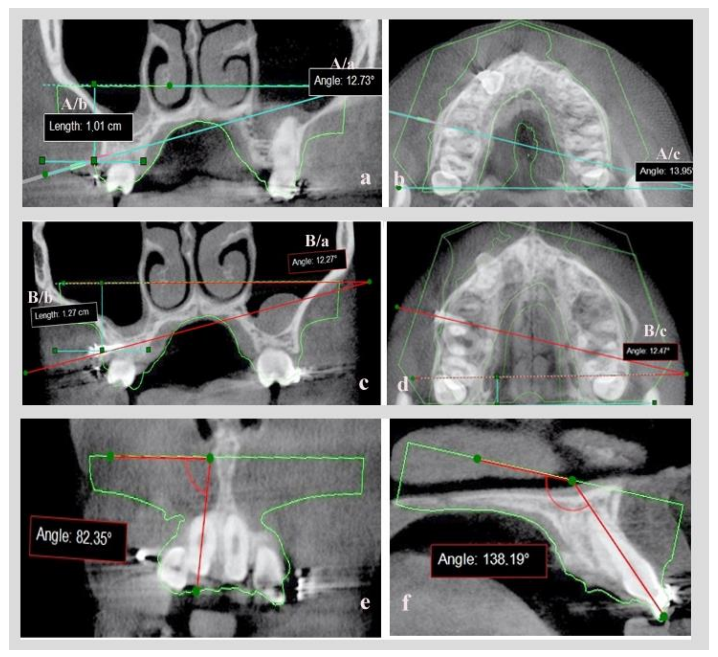 Dentistry 10 00104 g005