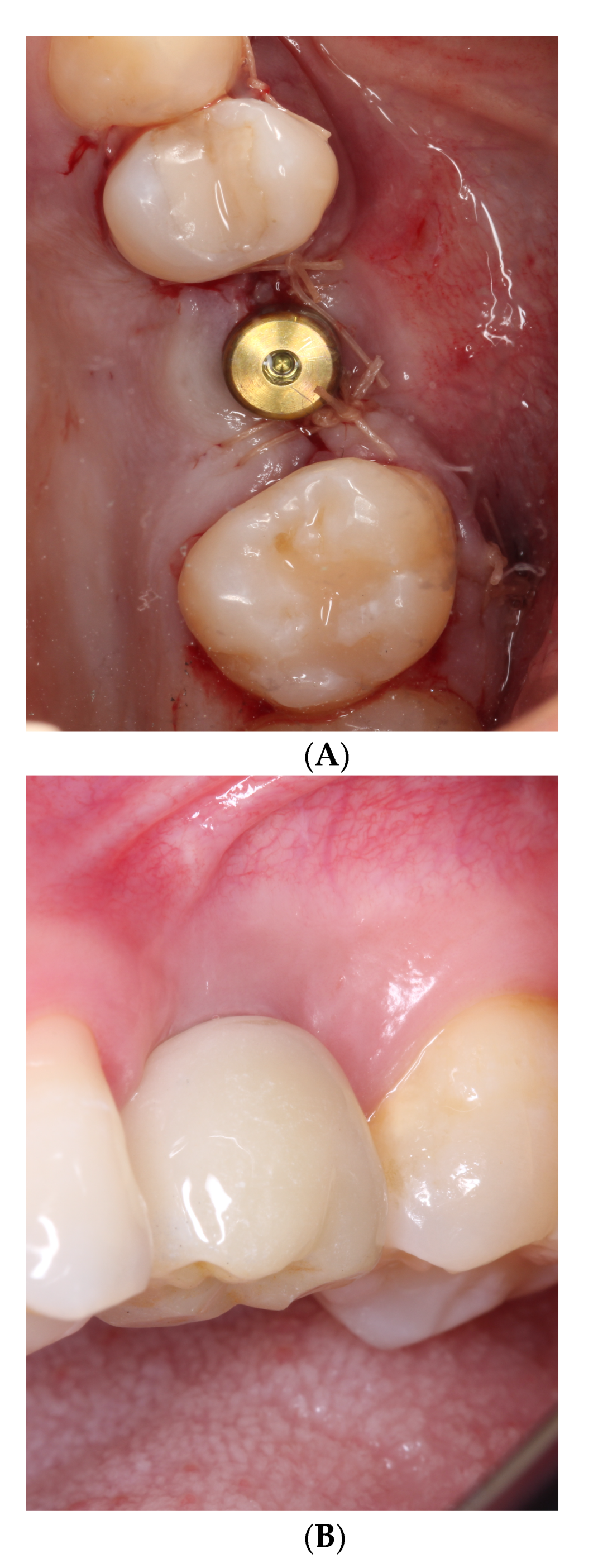 Dentistry 10 00113 g003