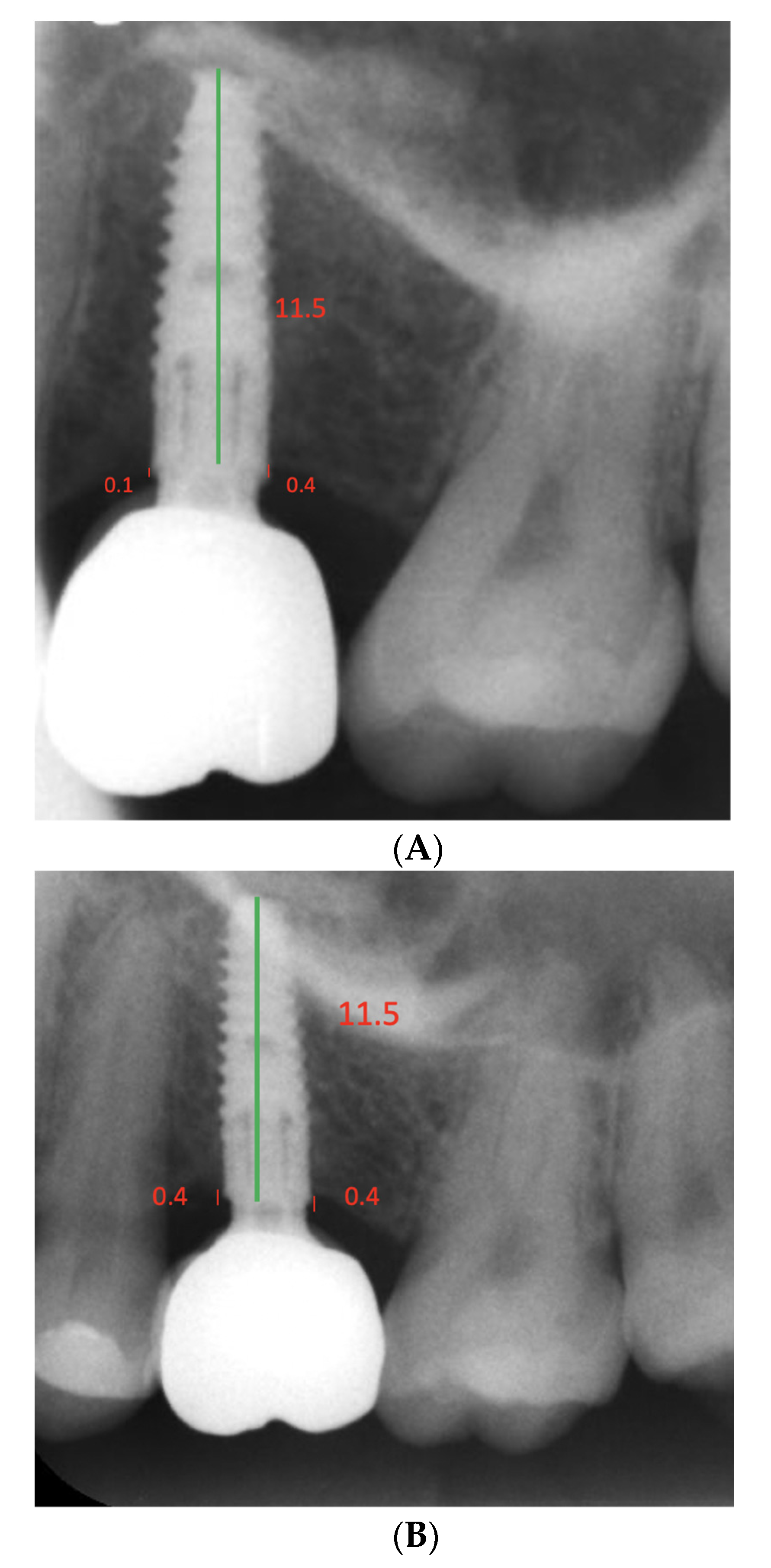 Dentistry 10 00113 g004