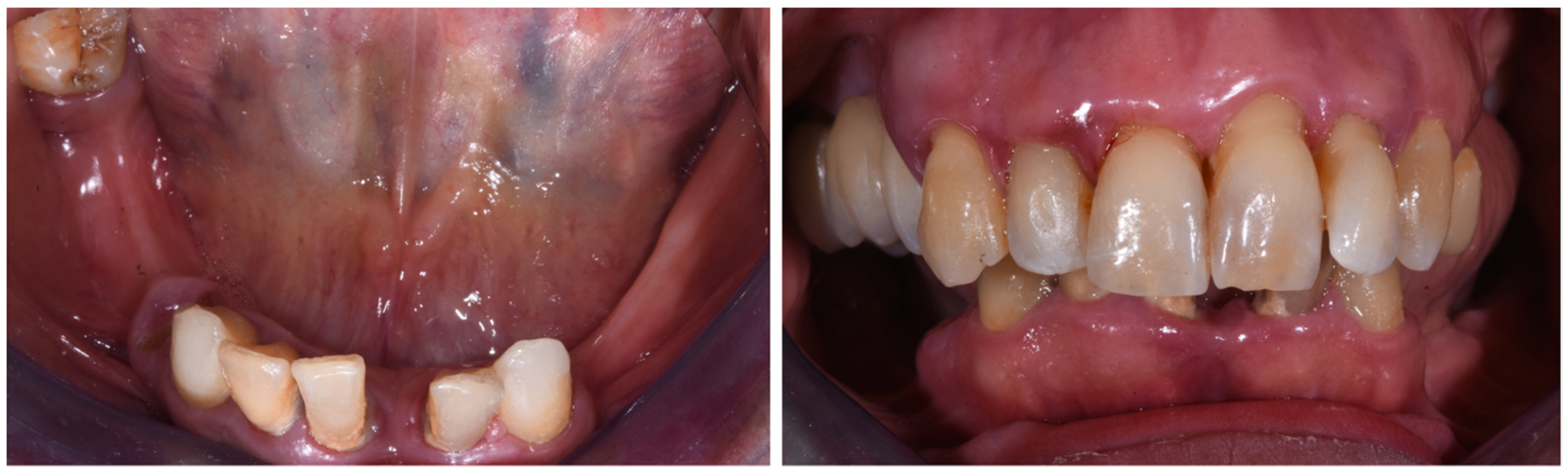 Dentistry 10 00116 g001 550