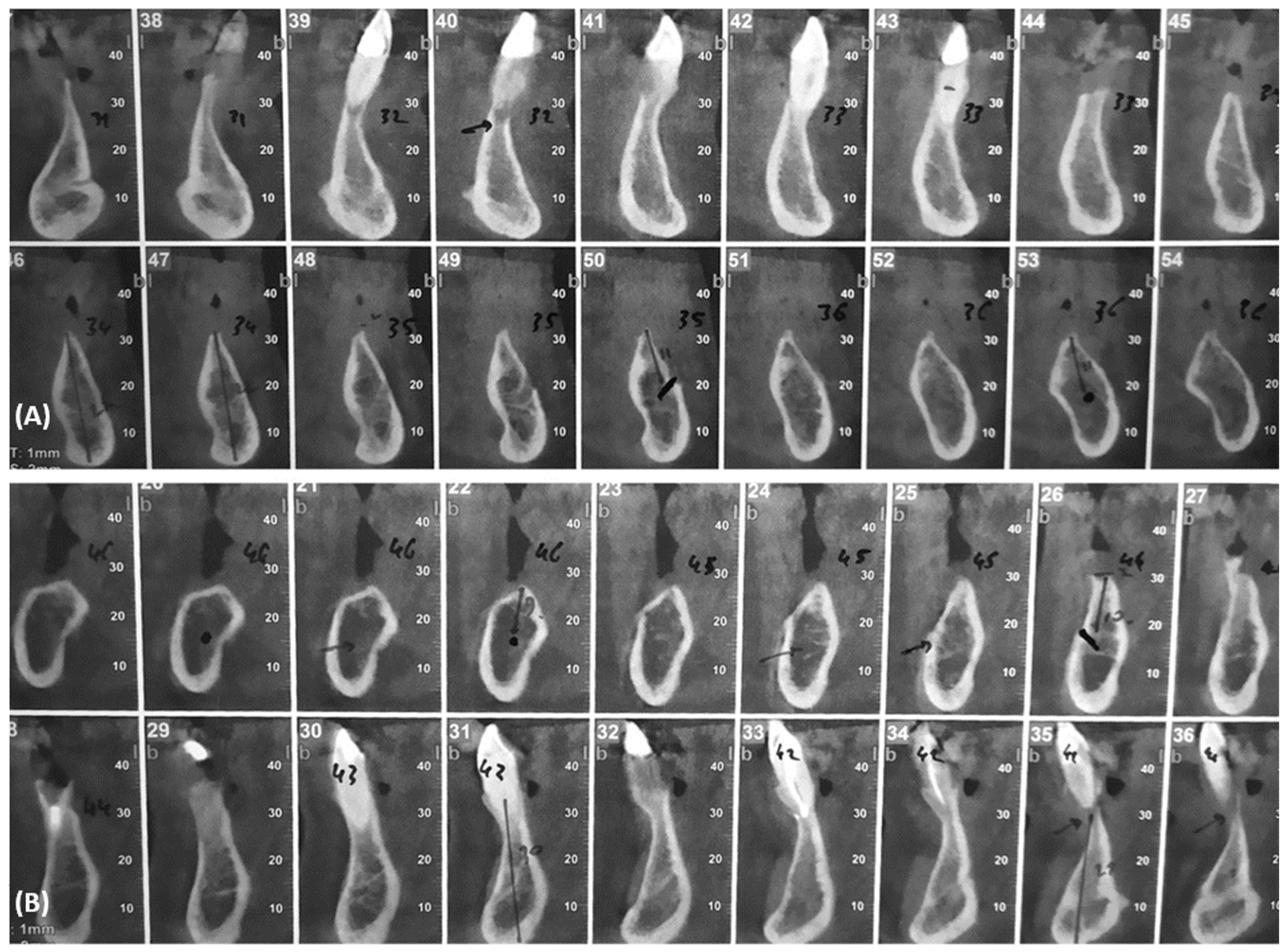 Dentistry 10 00116 g003 550