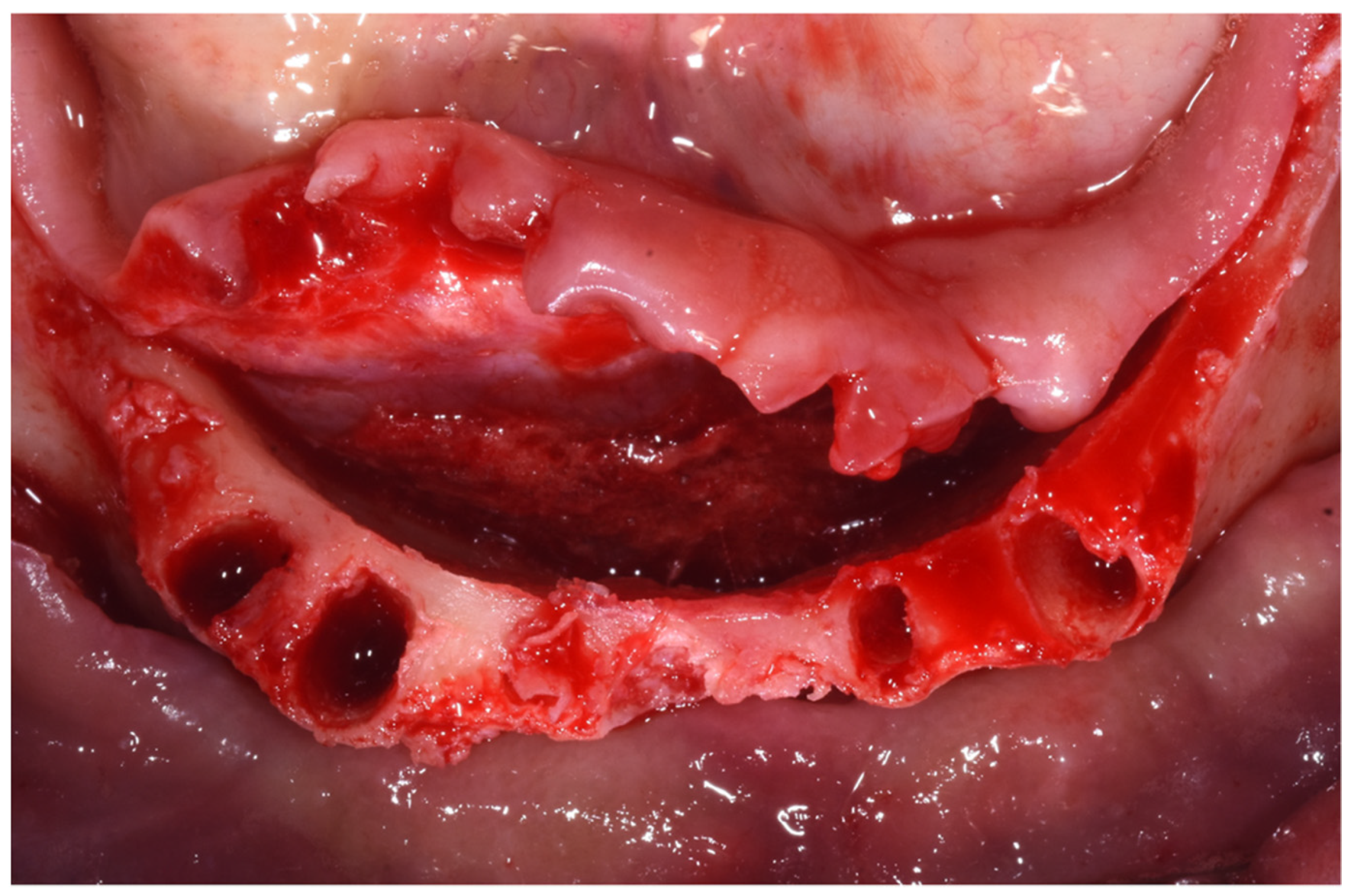 Dentistry 10 00116 g004 550