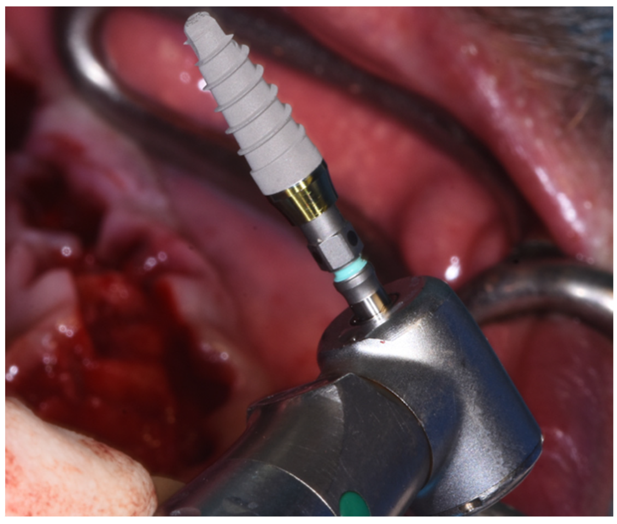 Dentistry 10 00116 g005 550