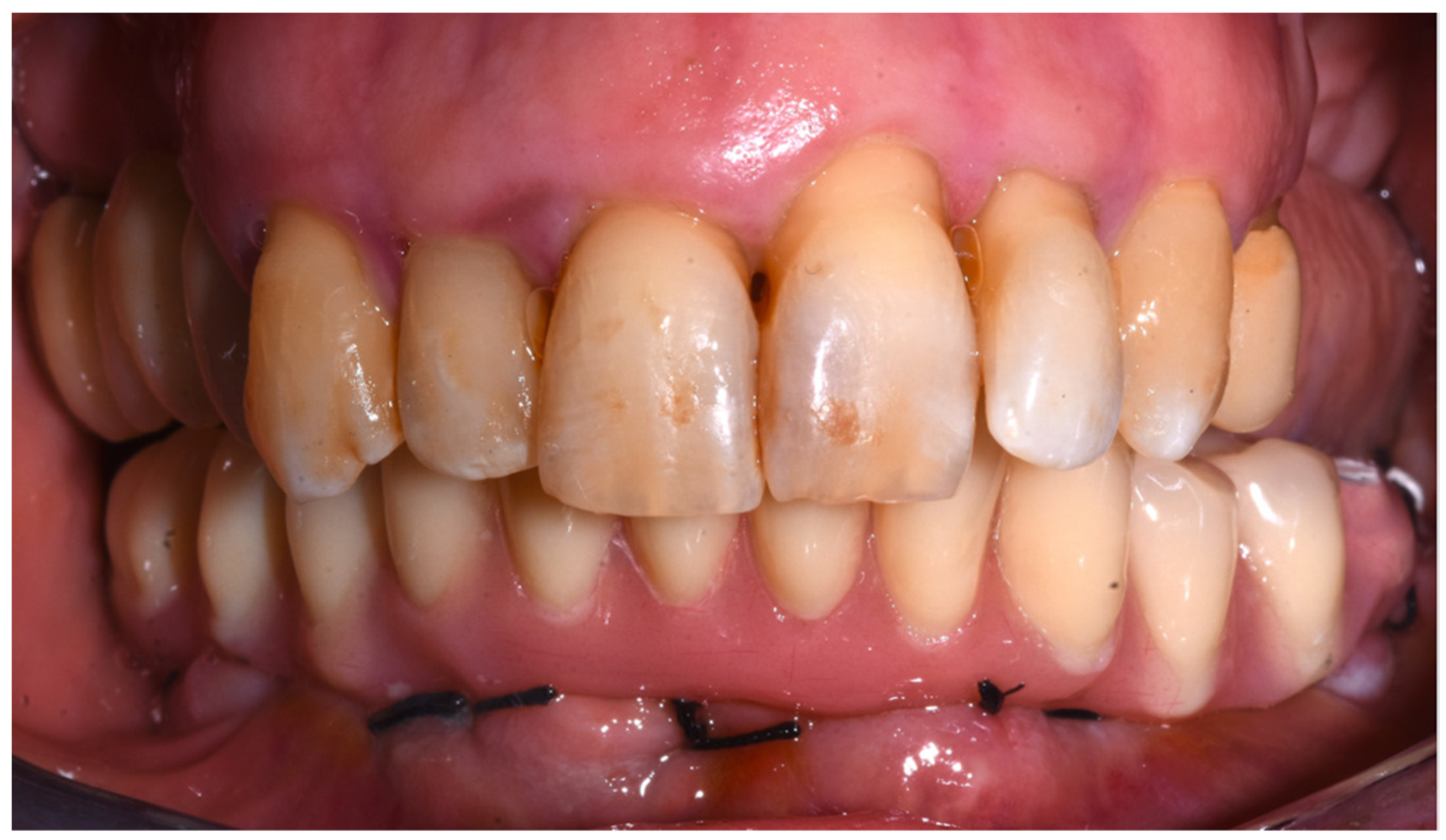 Dentistry 10 00116 g008 550