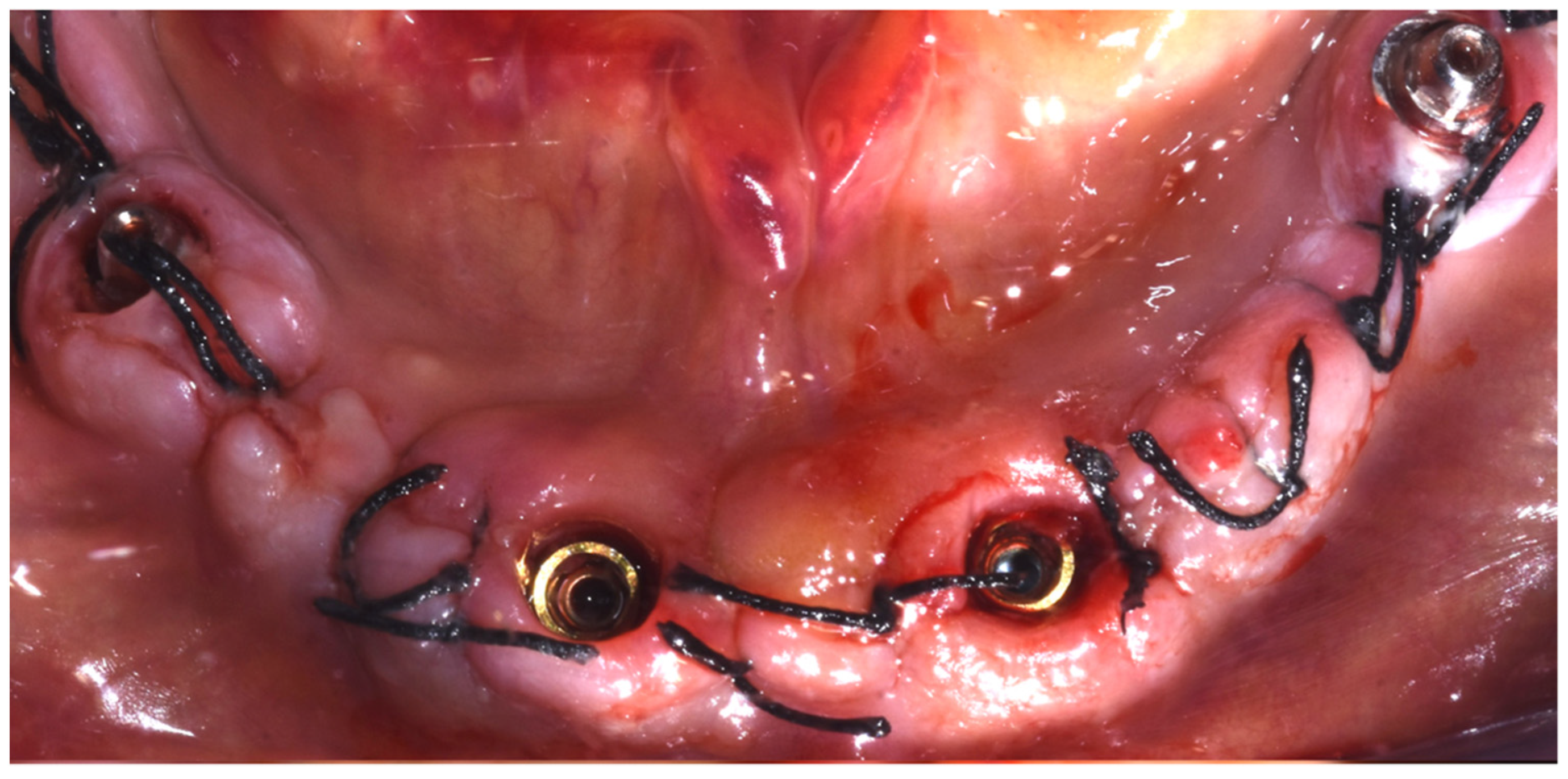 Dentistry 10 00116 g010 550