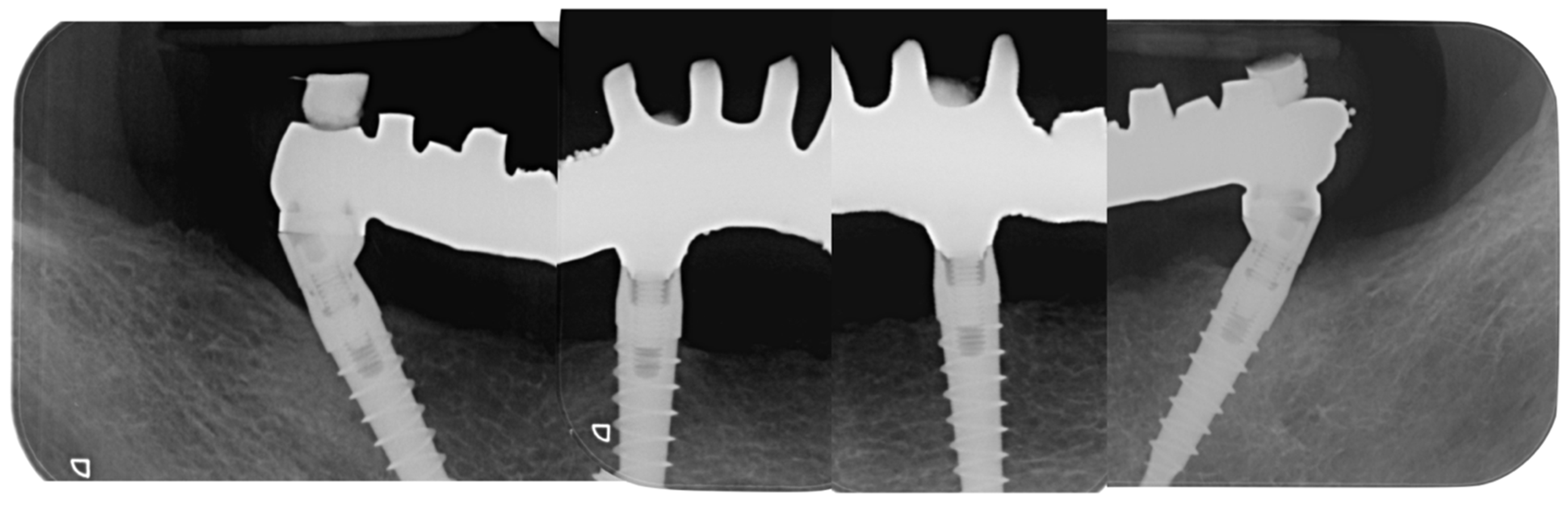 Dentistry 10 00116 g011 550