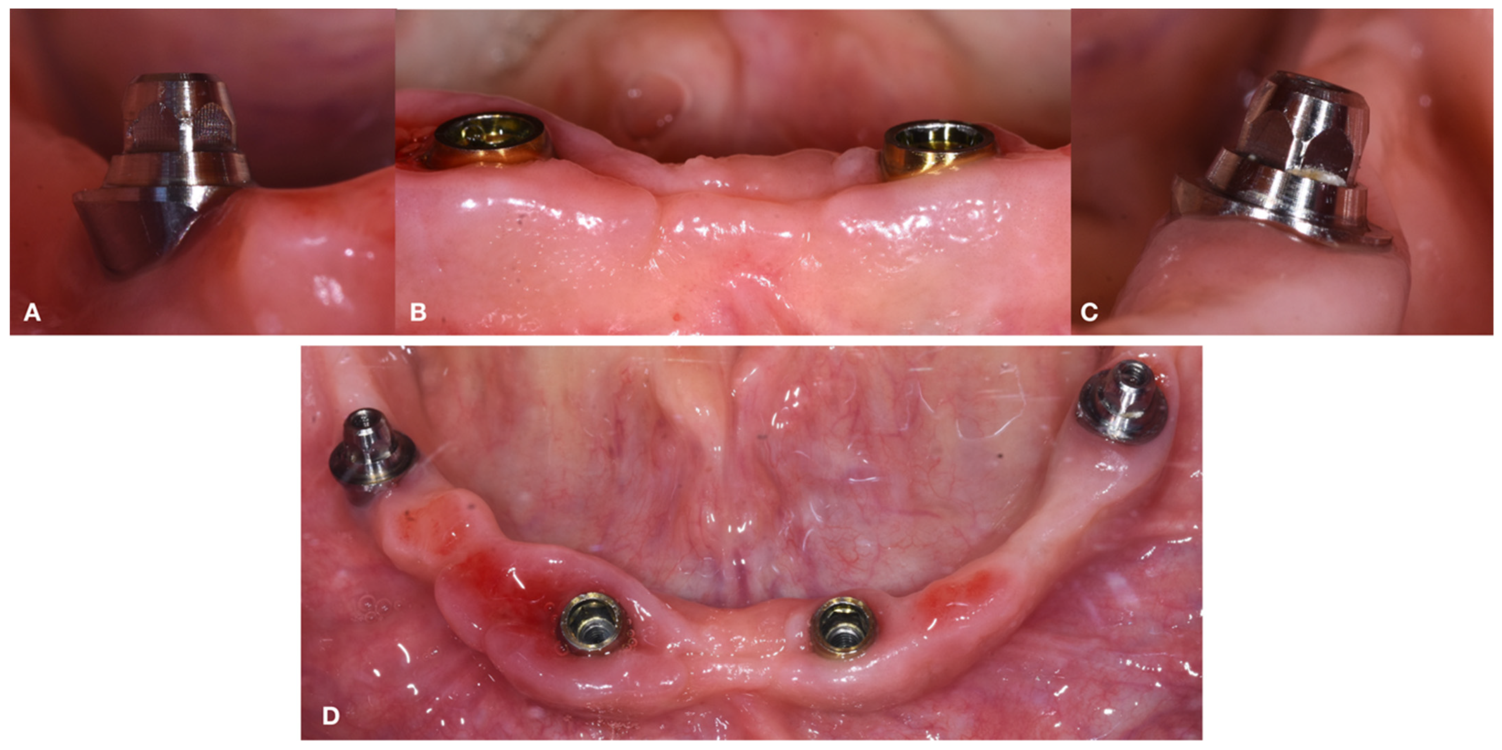 Dentistry 10 00116 g012 550