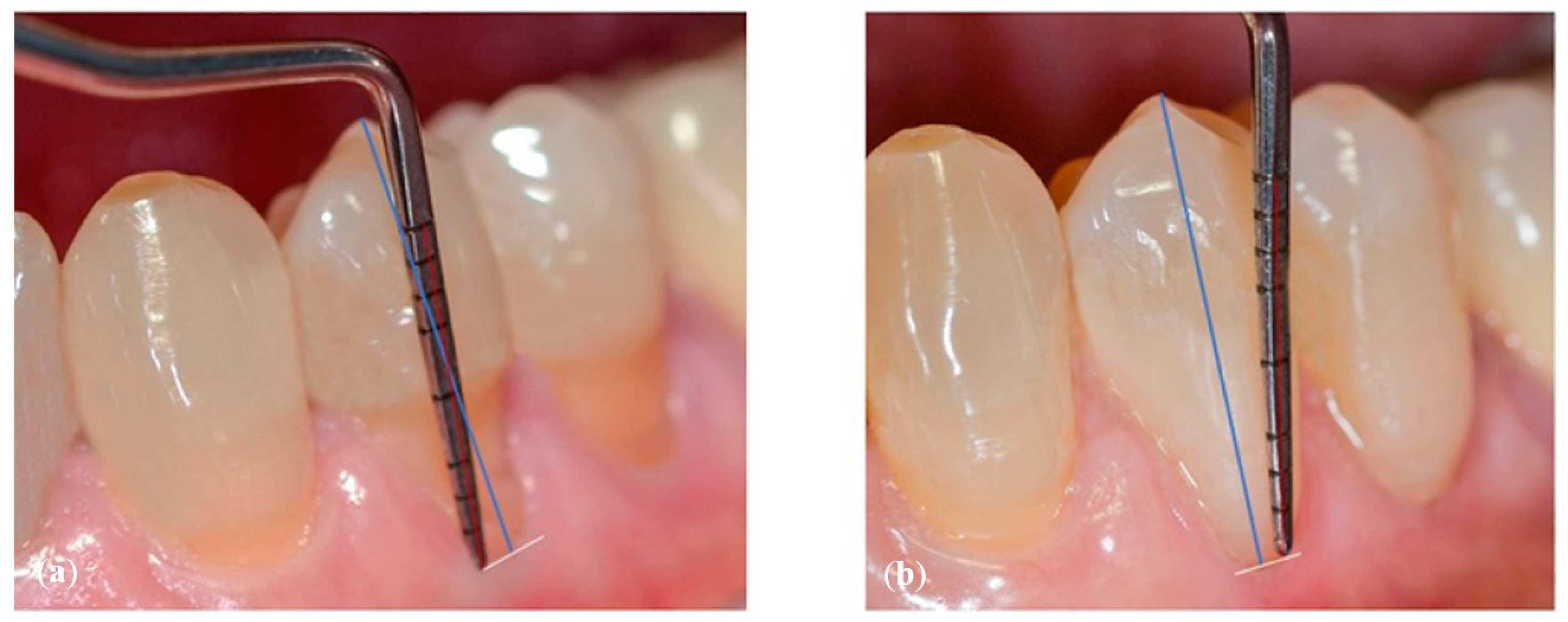 Dentistry 10 00132 g002 Dentistry 10 00132 g002