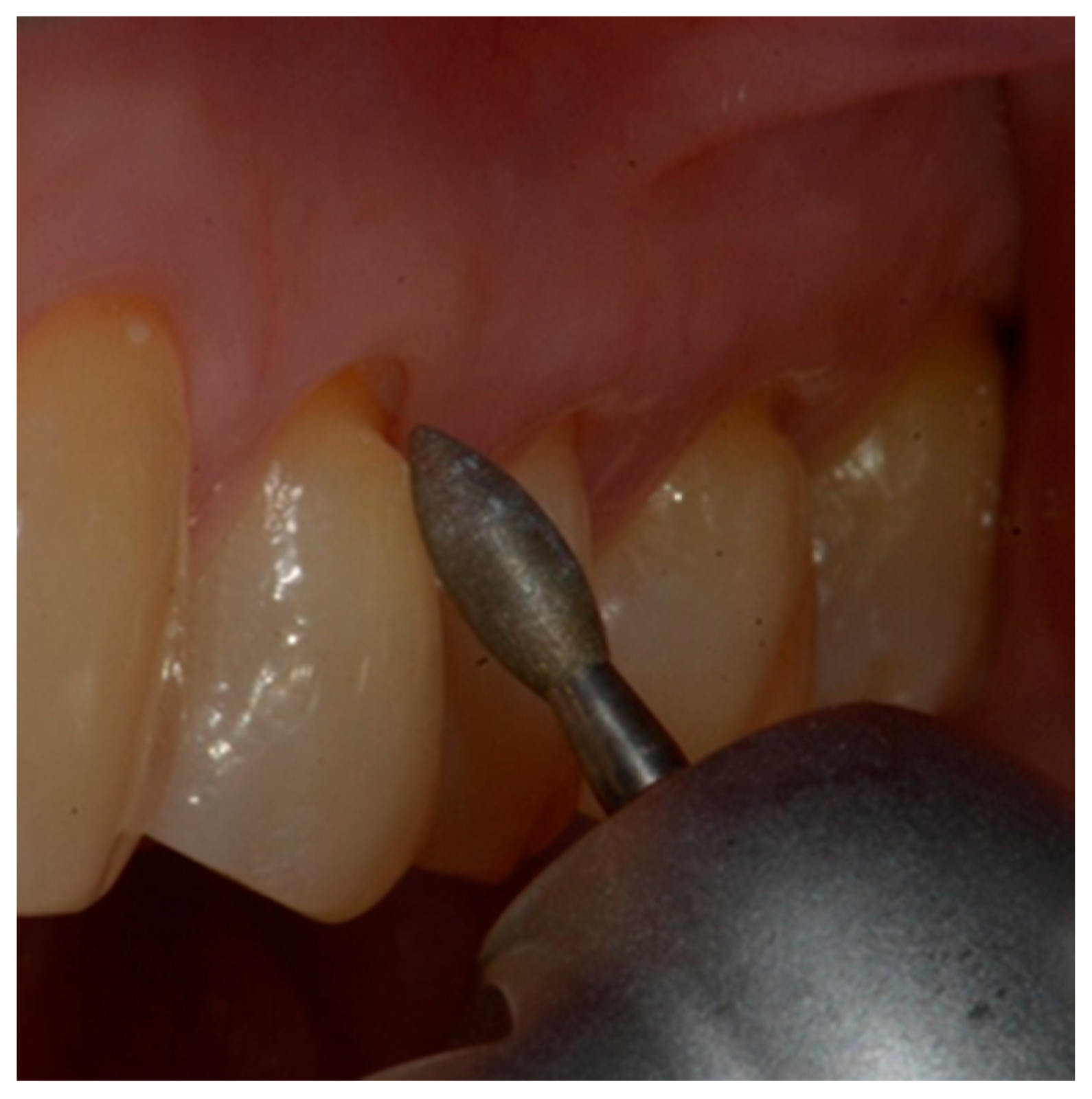 Dentistry 10 00132 g004 Dentistry 10 00132 g004