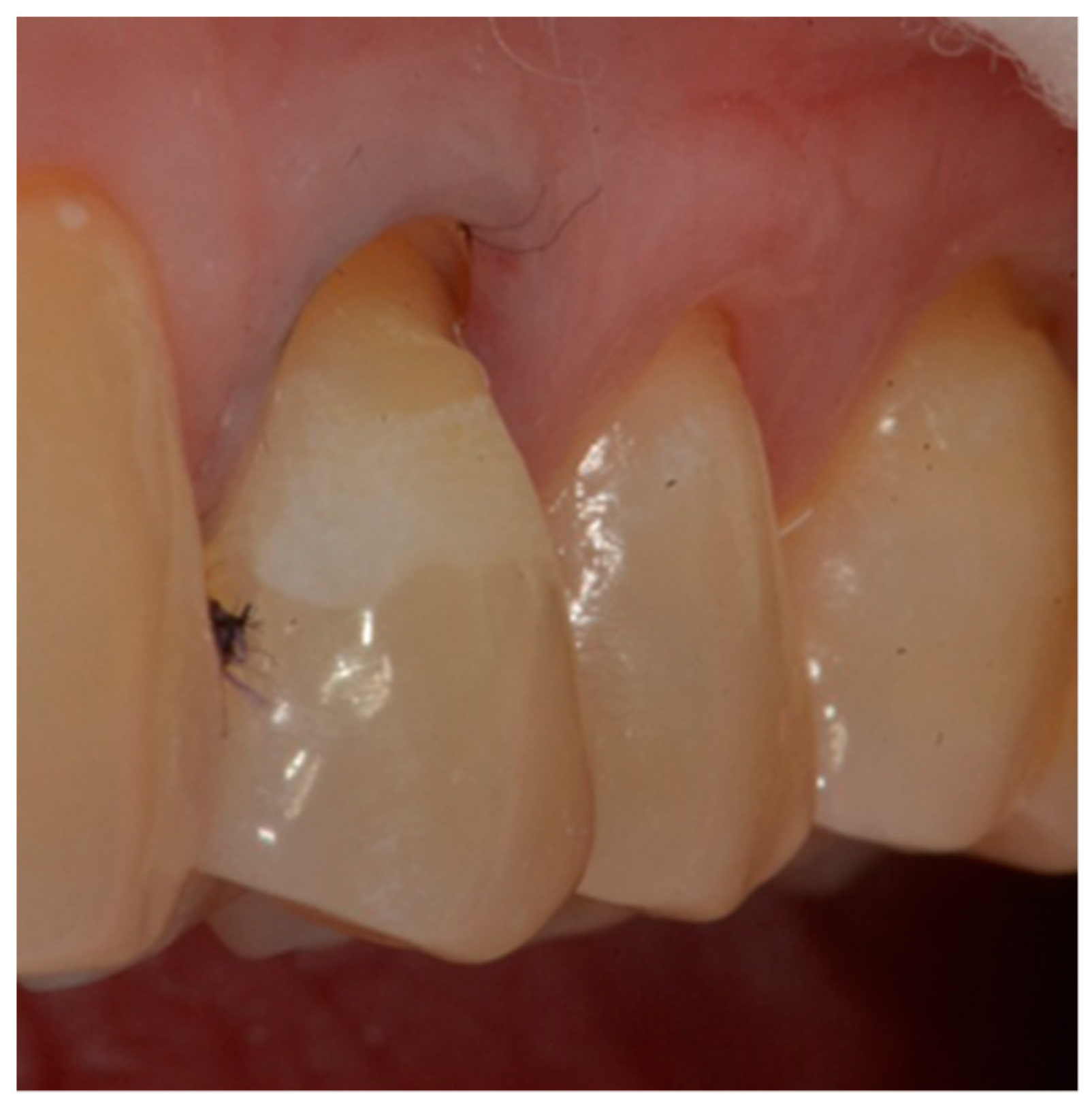 Dentistry 10 00132 g005 Dentistry 10 00132 g005