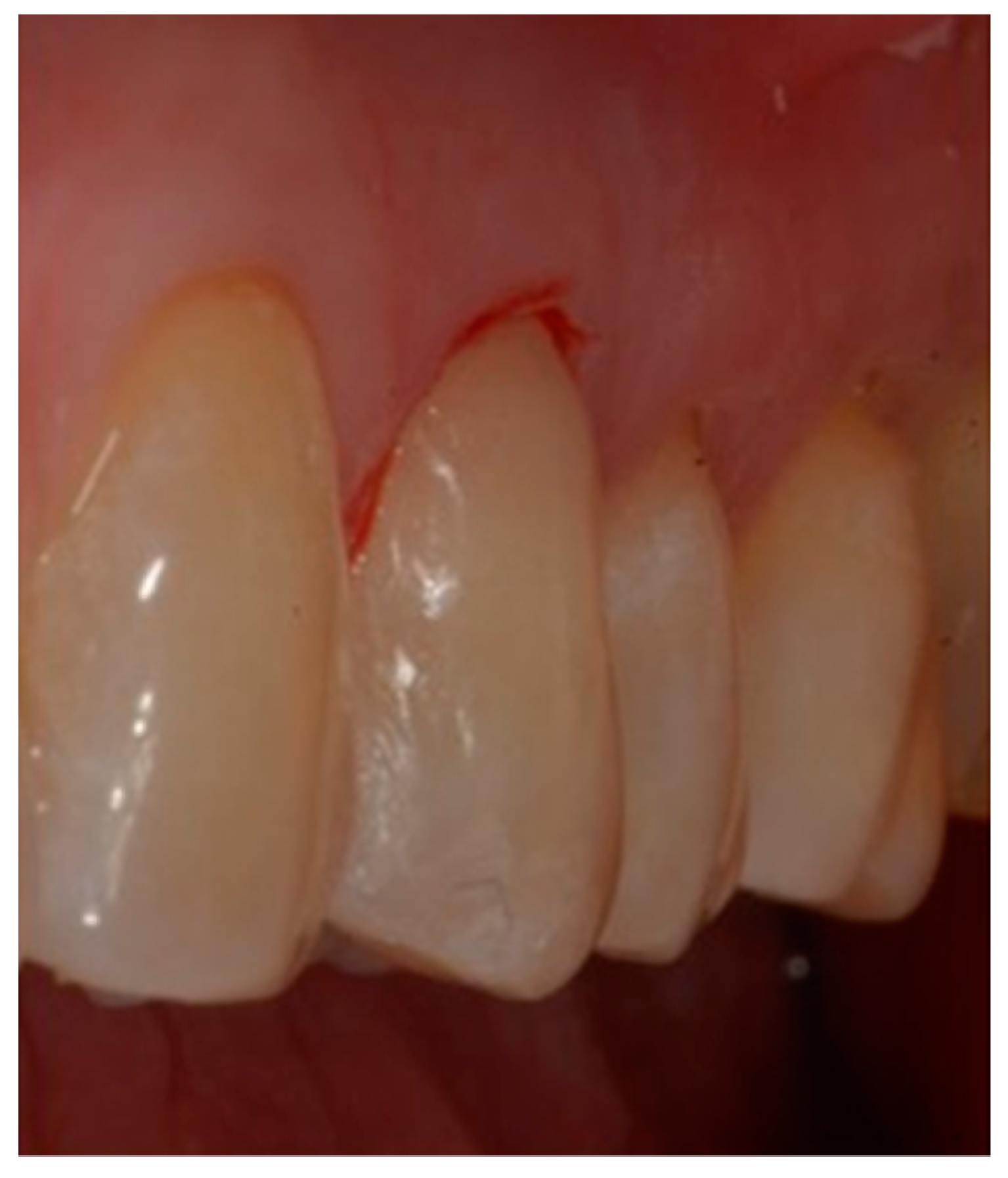 Dentistry 10 00132 g007 Dentistry 10 00132 g007